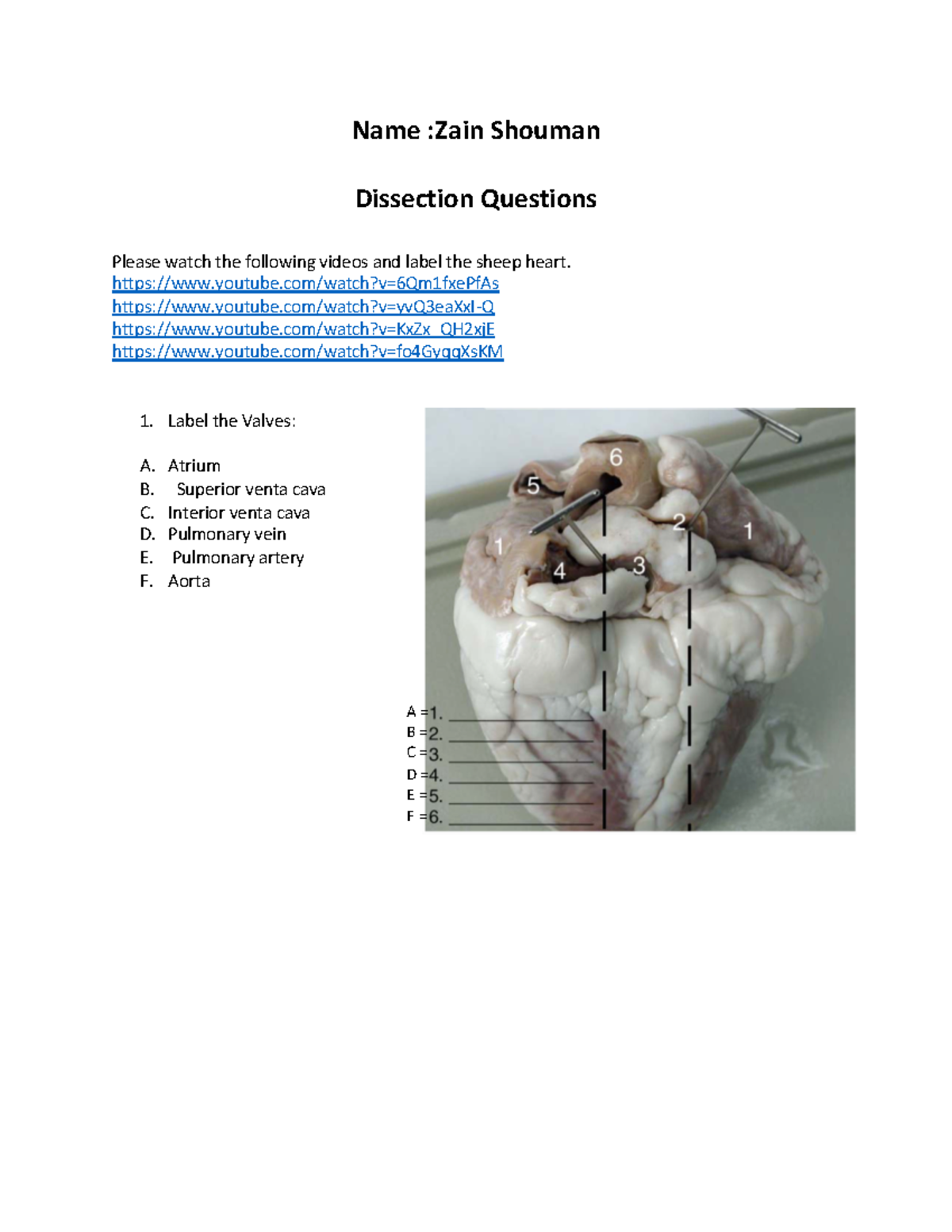 Heart Worksheet copy - Name :Zain Shouman Dissection Questions Please ...