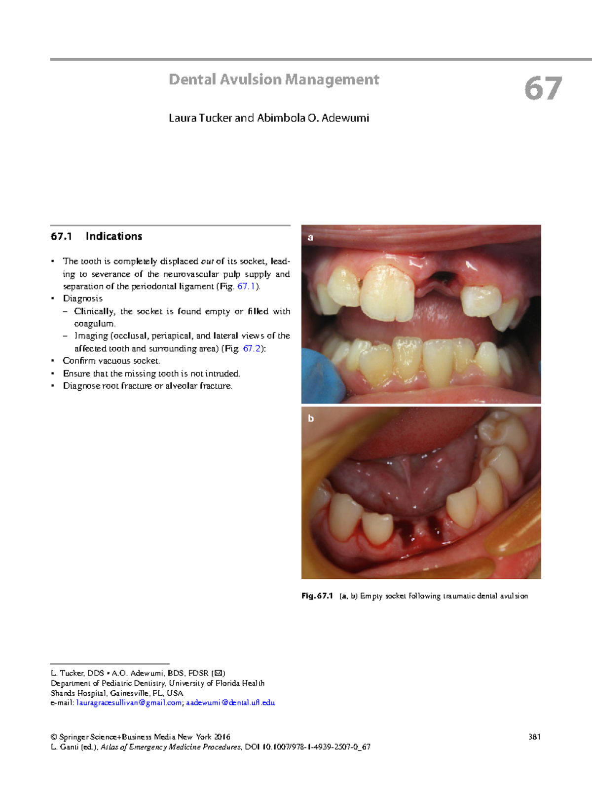 Dental Avulsion Management - ' Springer Science+Business Media New York ...