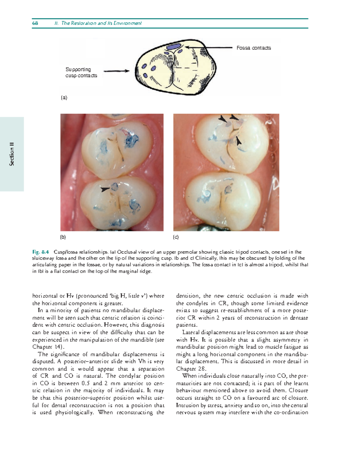 Restorative Dentistry An Integrated Approach-9 - 68 II. The Restoration ...