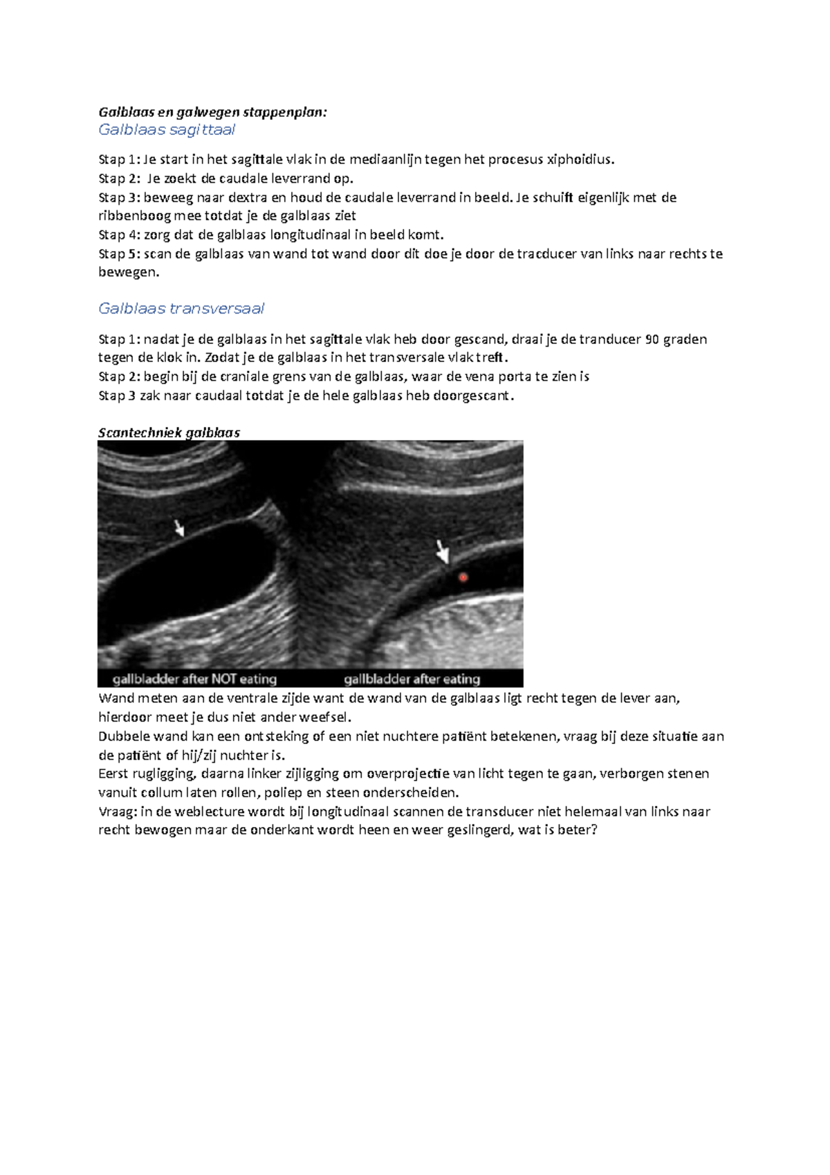Stappenplan EC galblaas en galwegen Galblaas en galwegen stappenplan Galblaas sagittaal Stap