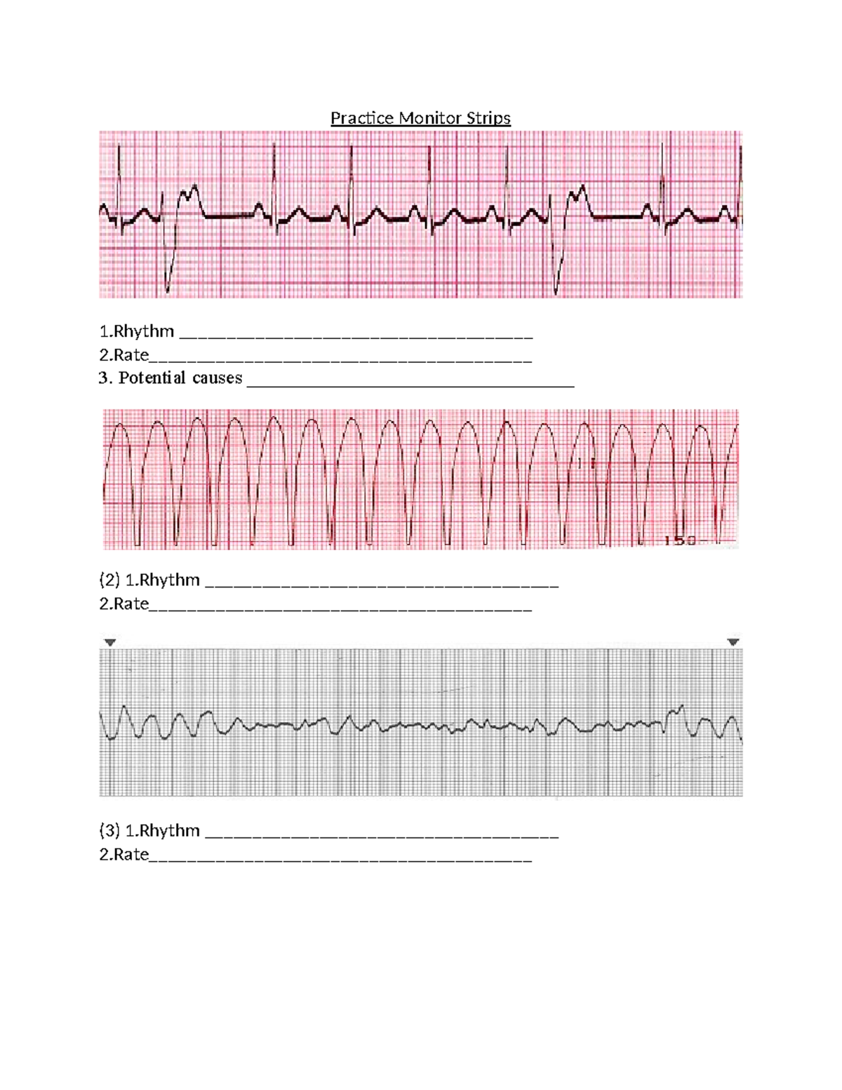 Practice Monitor Ventricular-1 - NUR 265 - Practice Monitor Strips 1 ...