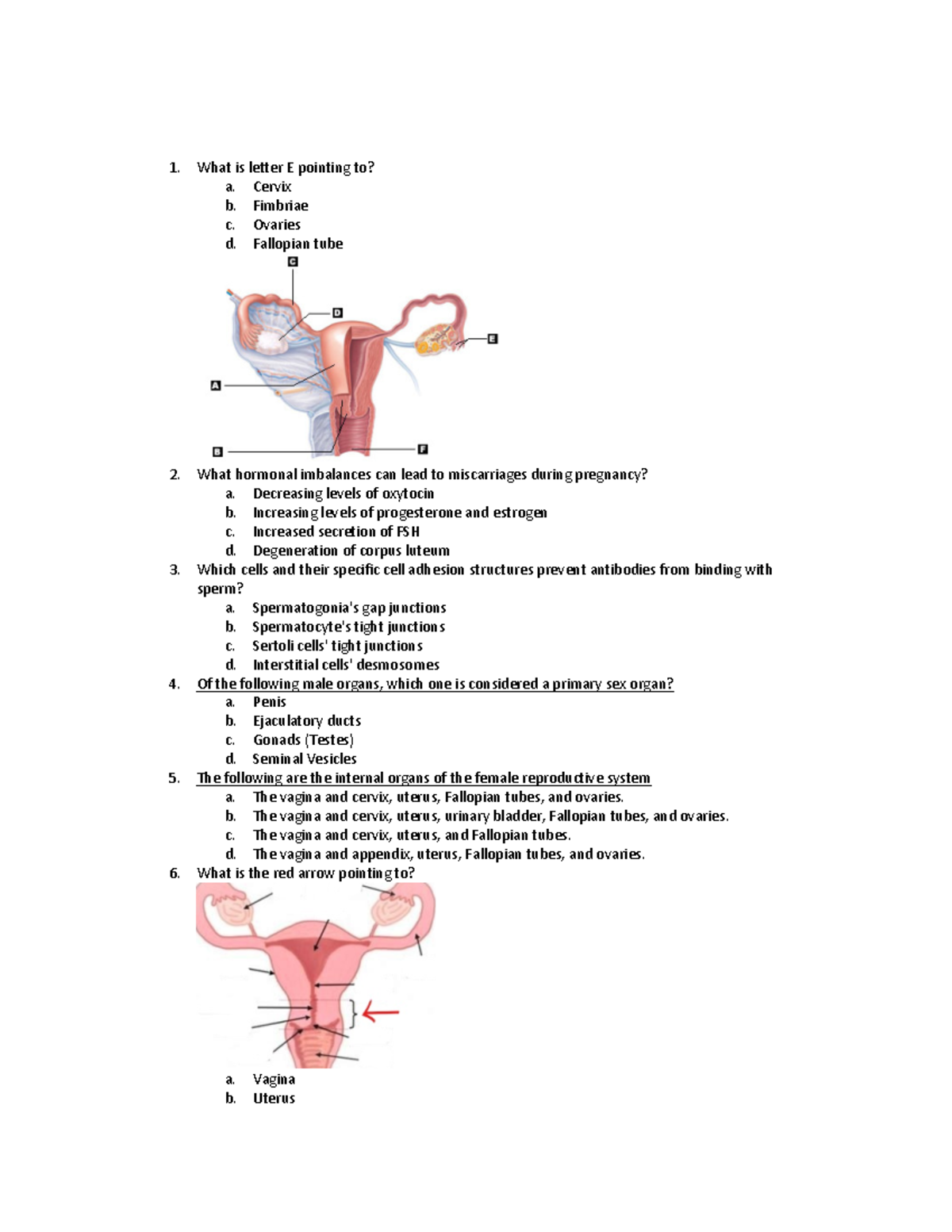 1300 final exam guide and key terms-1 - What is letter E pointing to? a ...