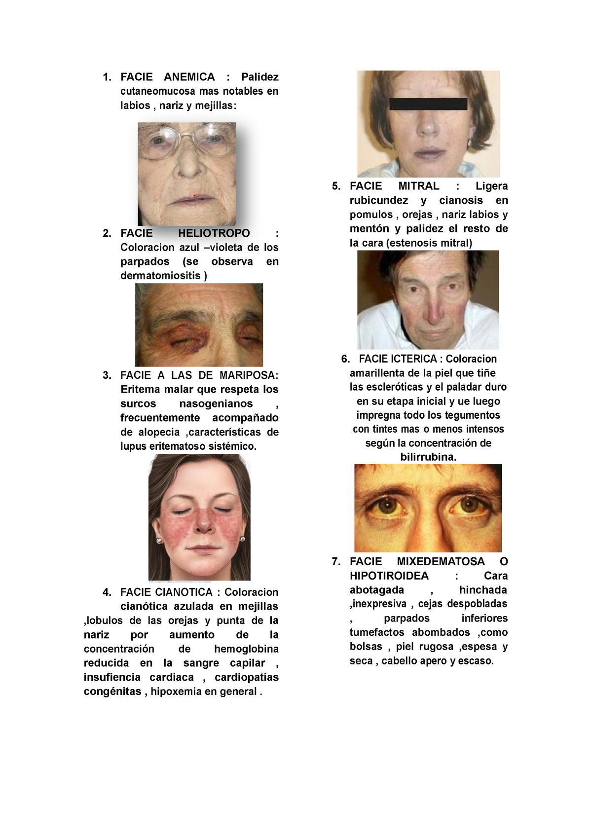 Facies Facie Anemica Palidez Cutaneomucosa Mas Notables En Labios