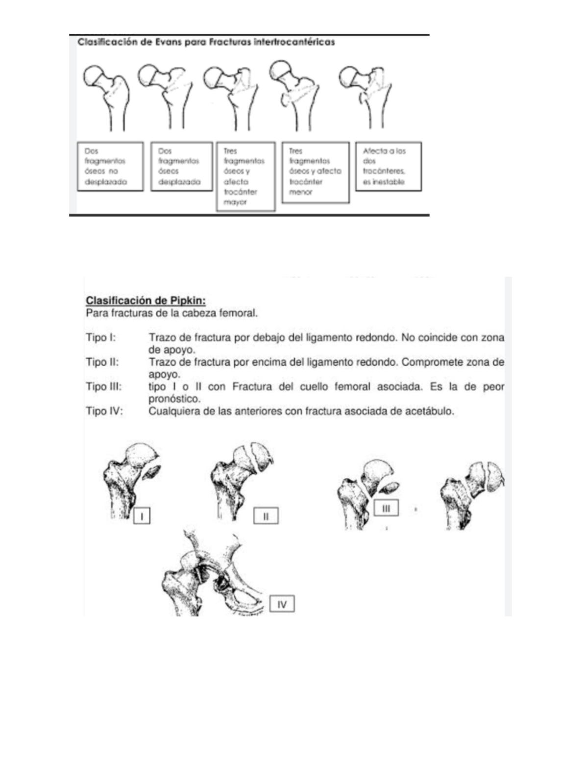 Tablas clasificacion de fracturas Ortopedia I Studocu