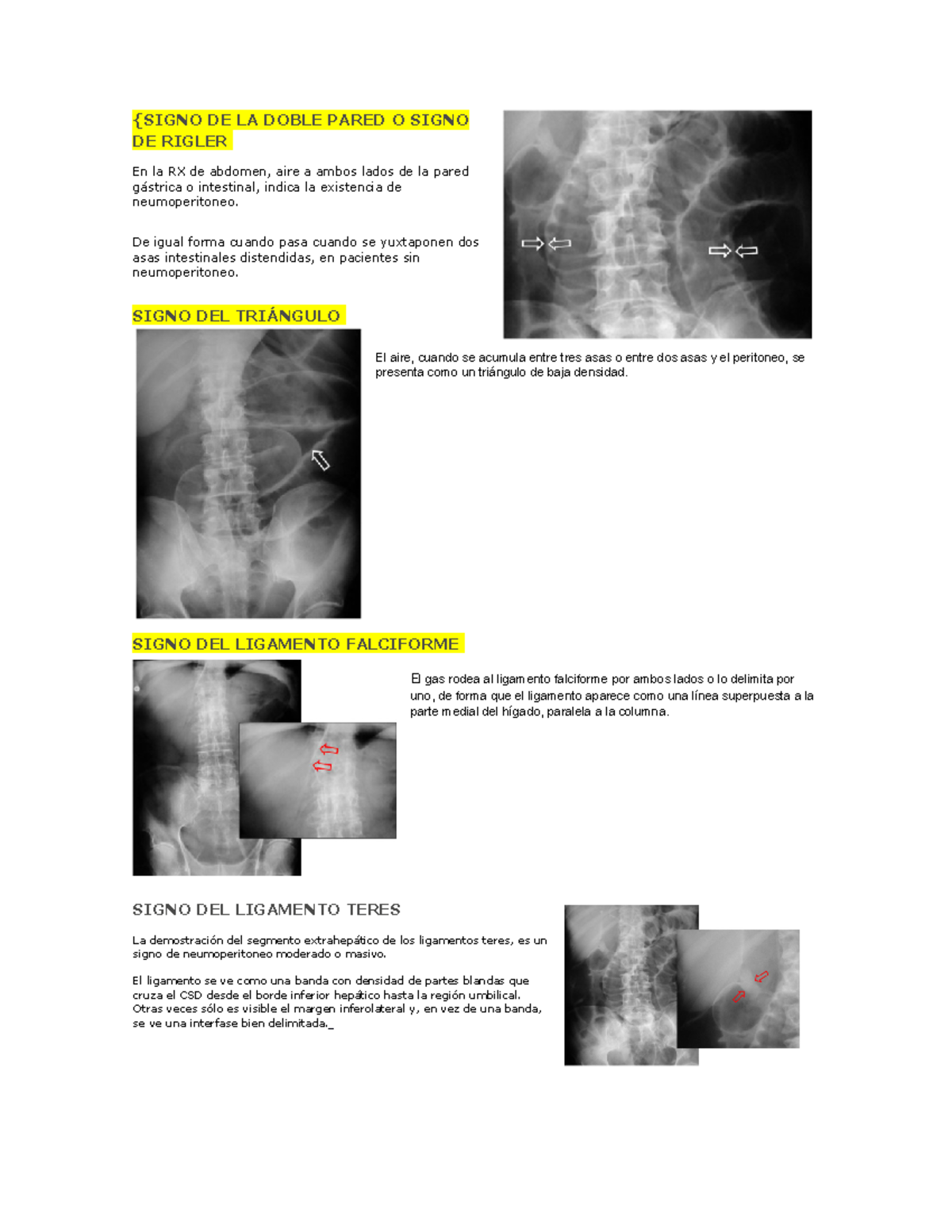 Signo DE LA Doble Pared O Signo DE Rigler - {SIGNO DE LA DOBLE PARED O ...