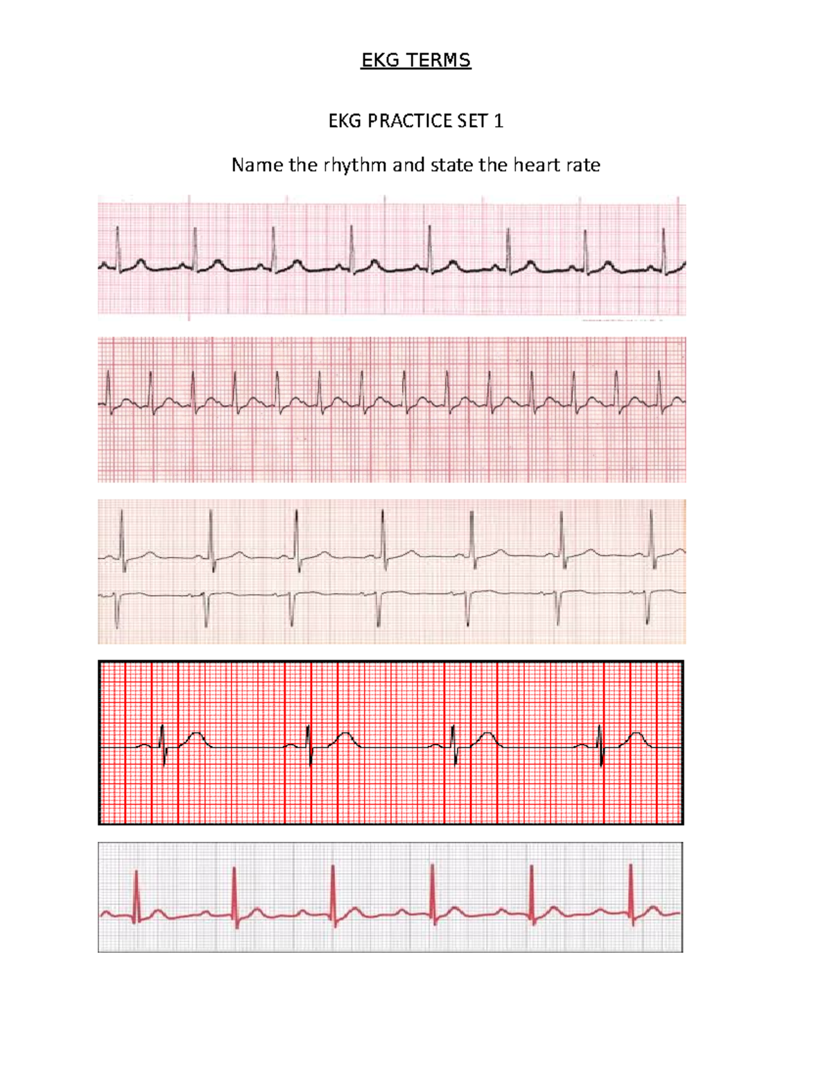 EKG Practice - EKG PRACTICE SET 1 Name the rhythm and state the heart ...