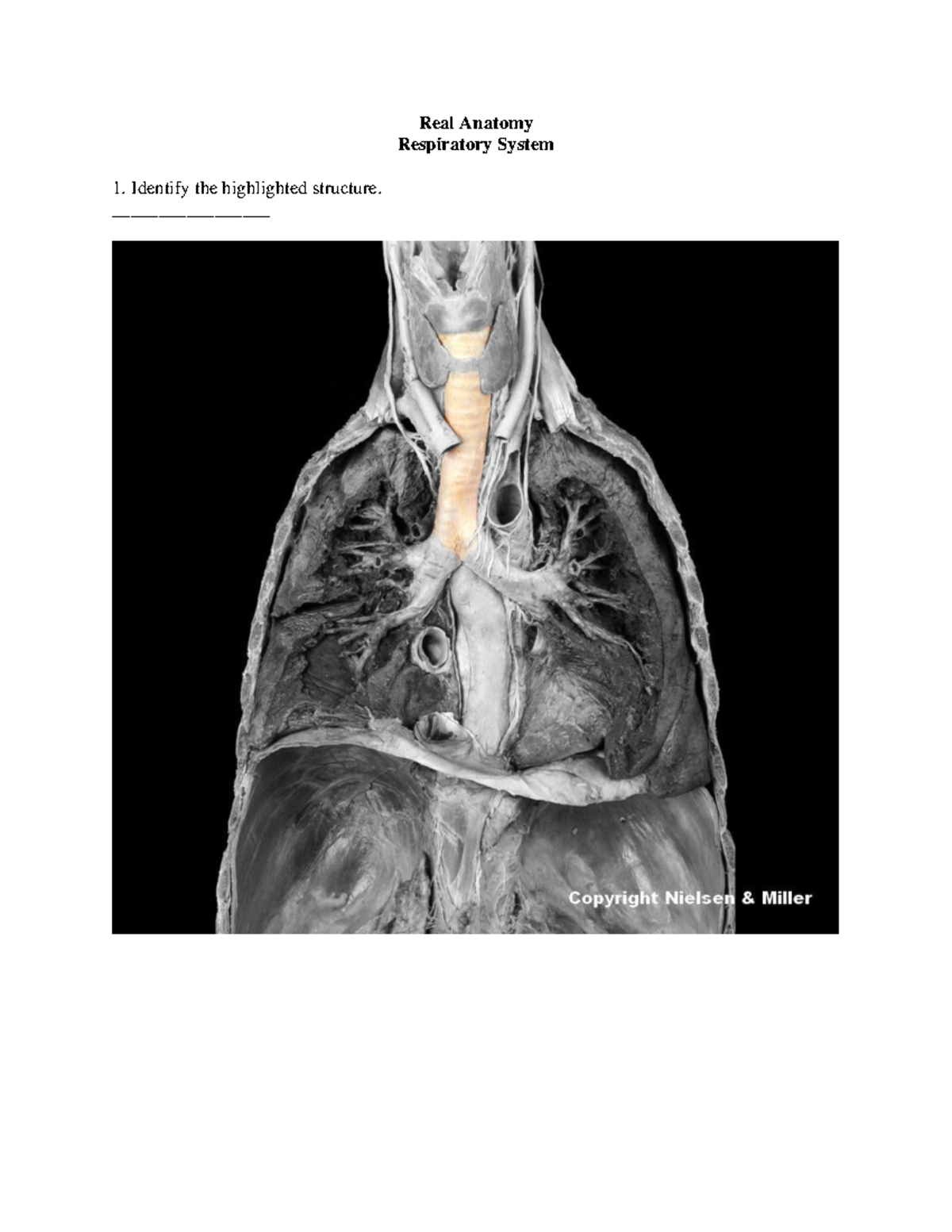 Identify The Highlighted Structure Urinary Systemfull Size Bronco Forum - 63asr52