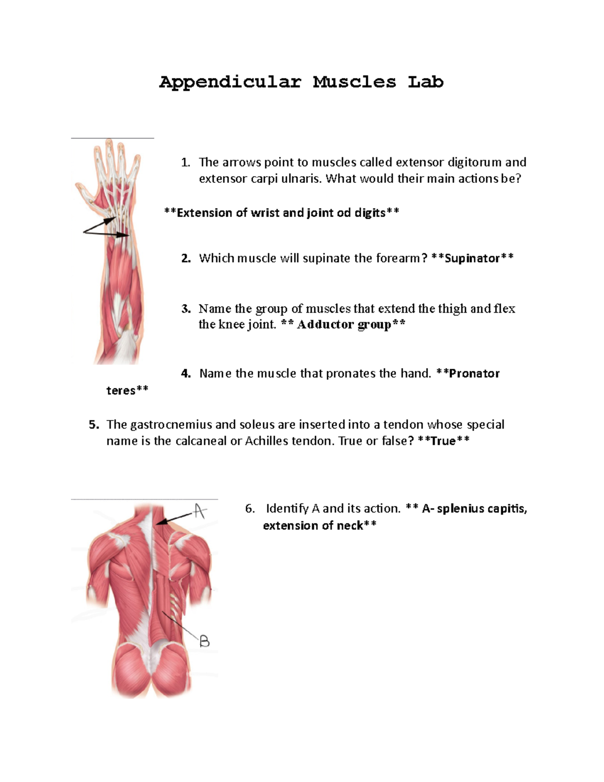 Appendicular Muscles Lab What would their main actions be? Extension