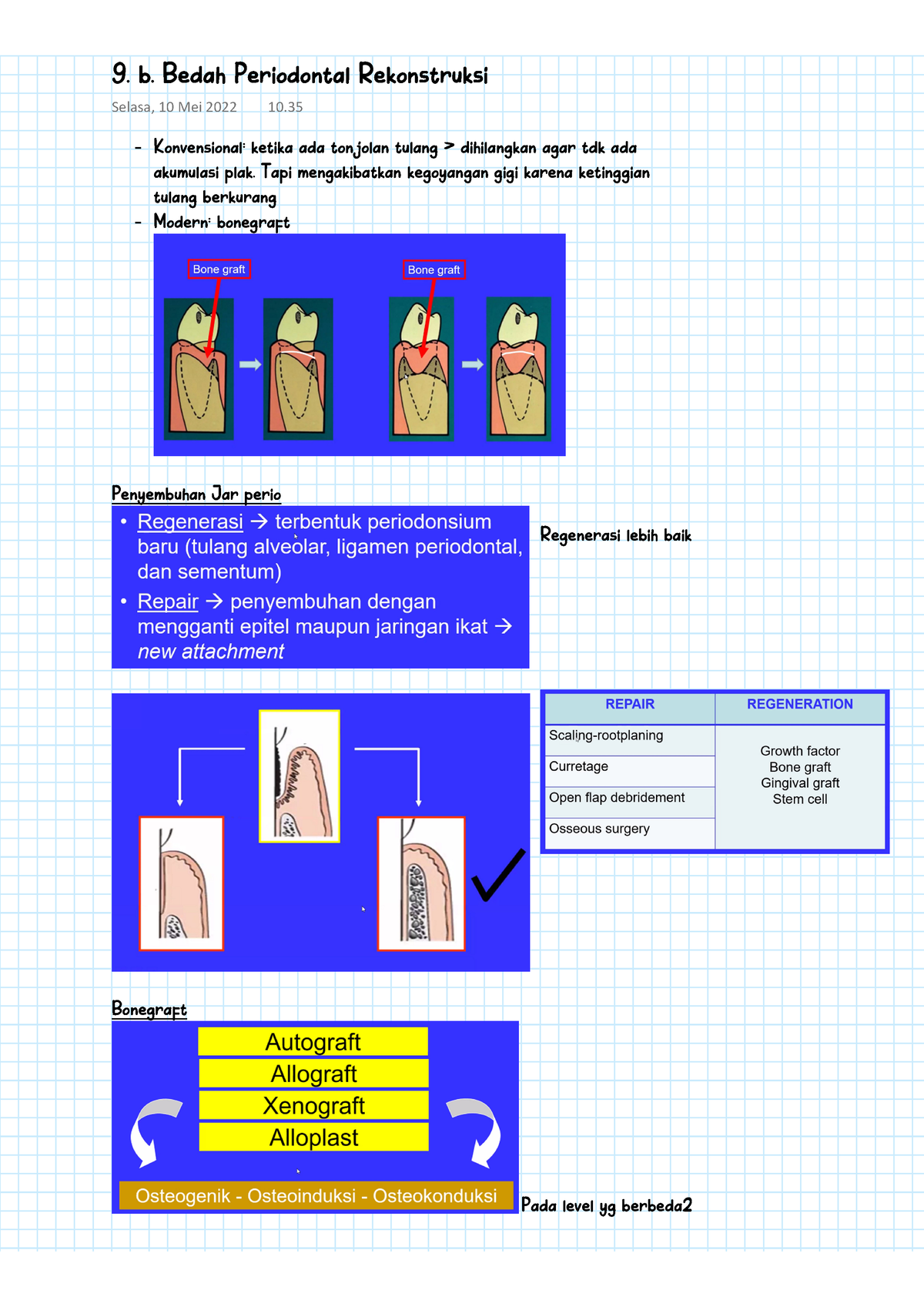 Periodonsia II - 9. B. Bedah Periodontal Rekonstruksi - Konvensional ...