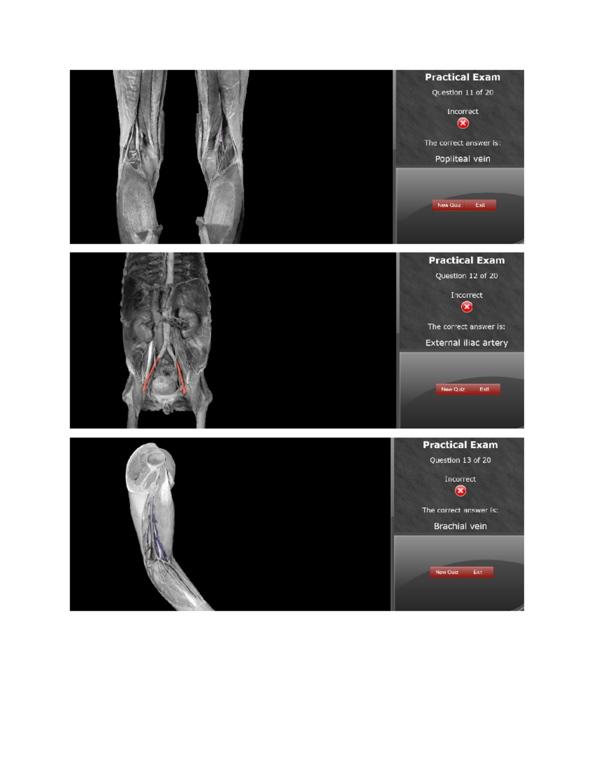 KIN262 Human anatomy Practical 7 - KIN 262 - Studocu