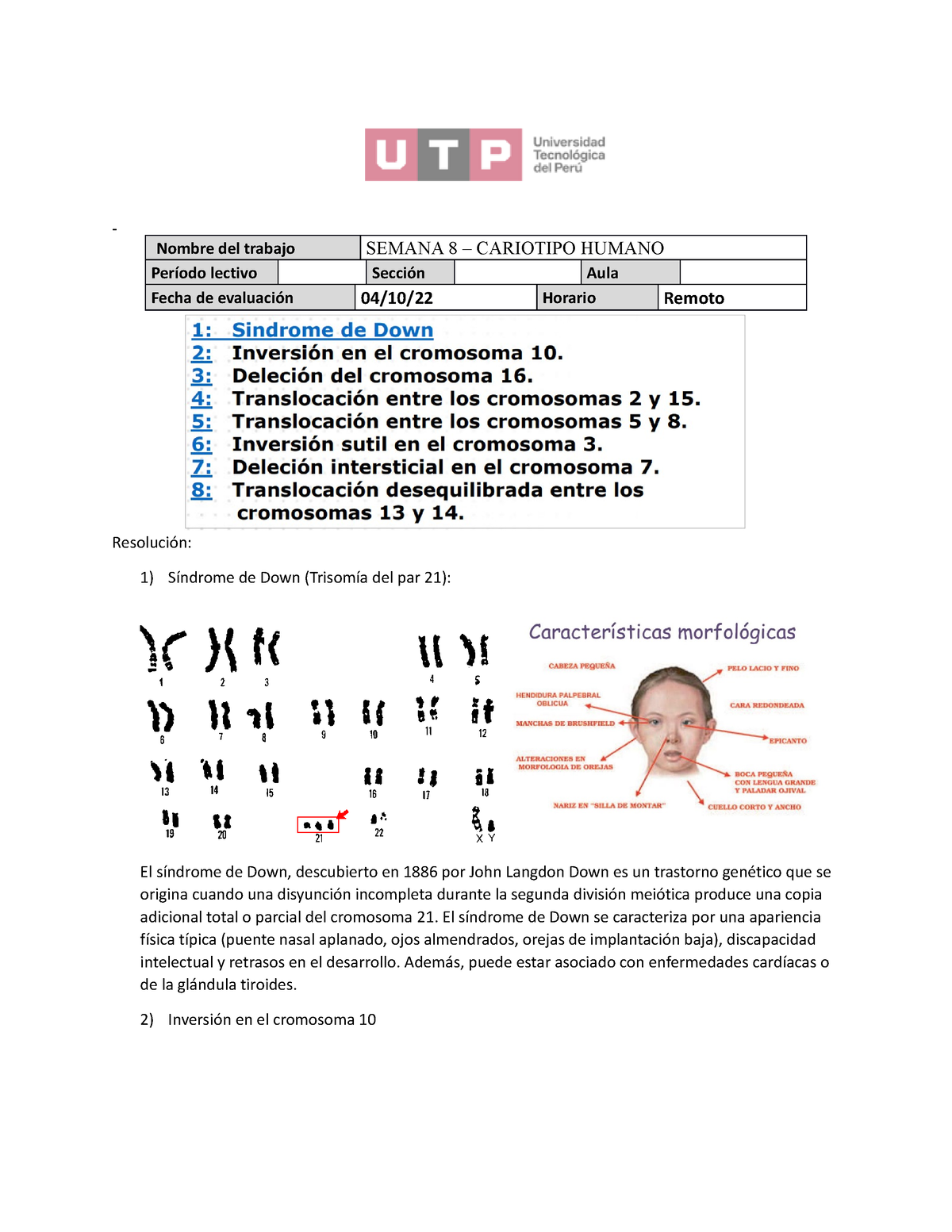 Ejercicio Repaso Anomalías Cromosómicas Semana 9 Resolución 1 Síndrome De Down Trisomía Del 8647