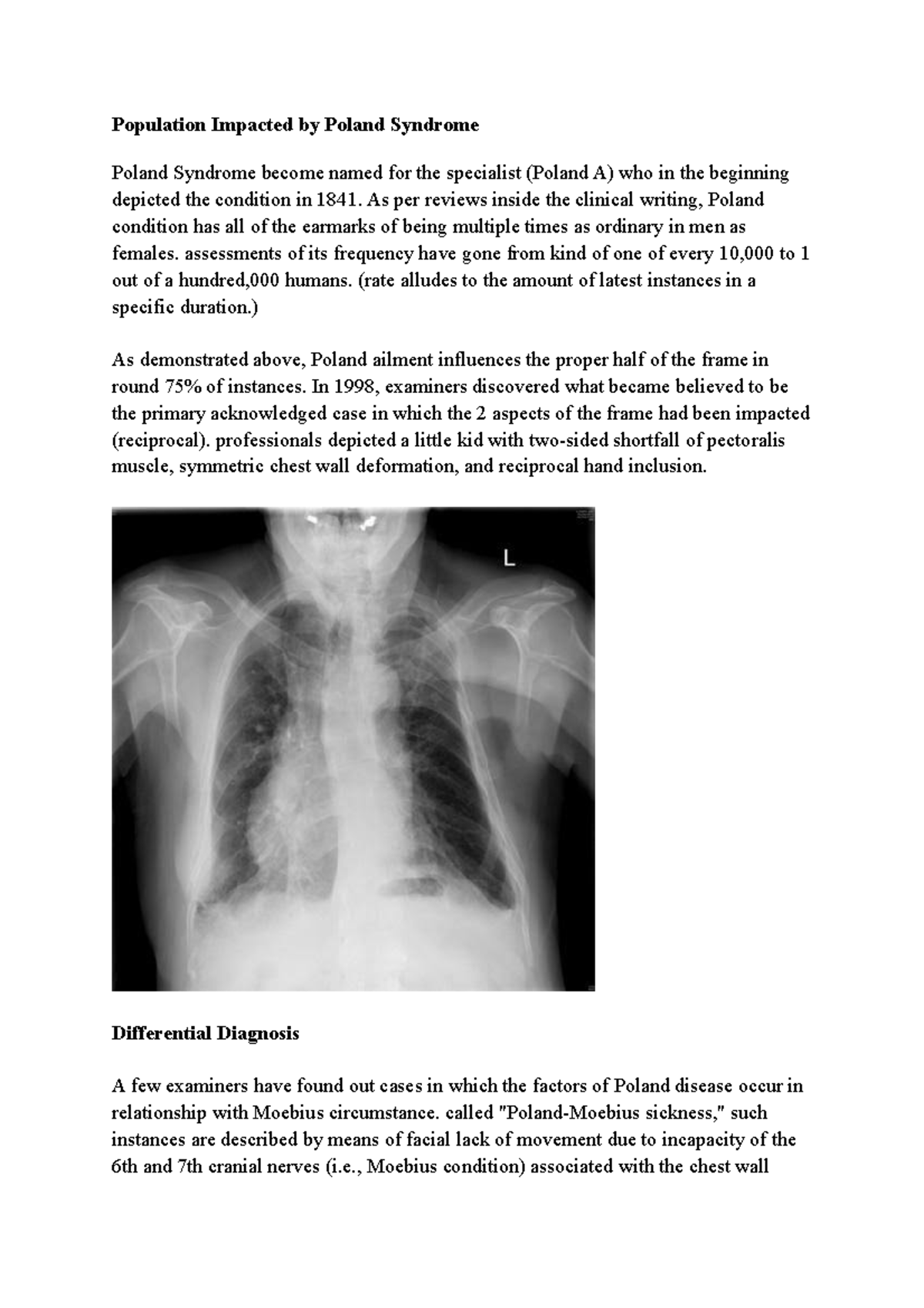 Diagnosis and Treatment of Poland Syndrome Population Impacted by