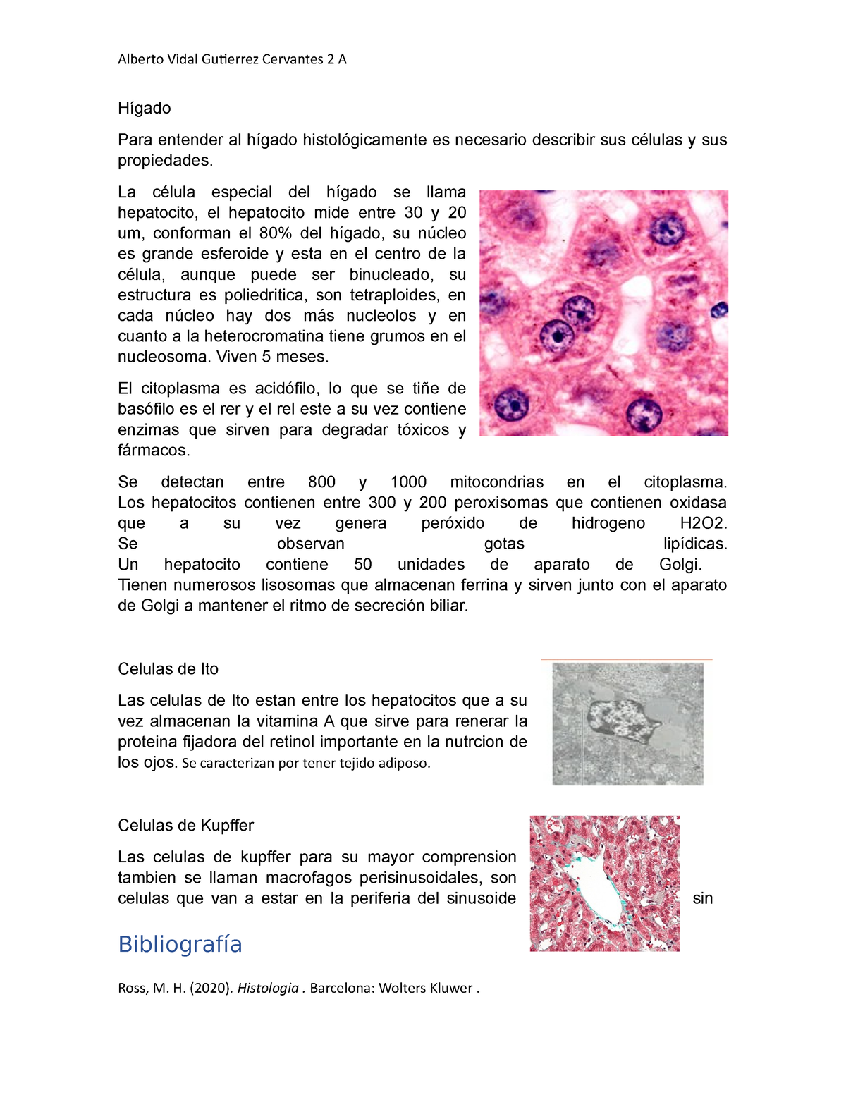 Histologia Del Higado Histología Texto Y Atlas Hígado Para Entender Al Hígado 5386