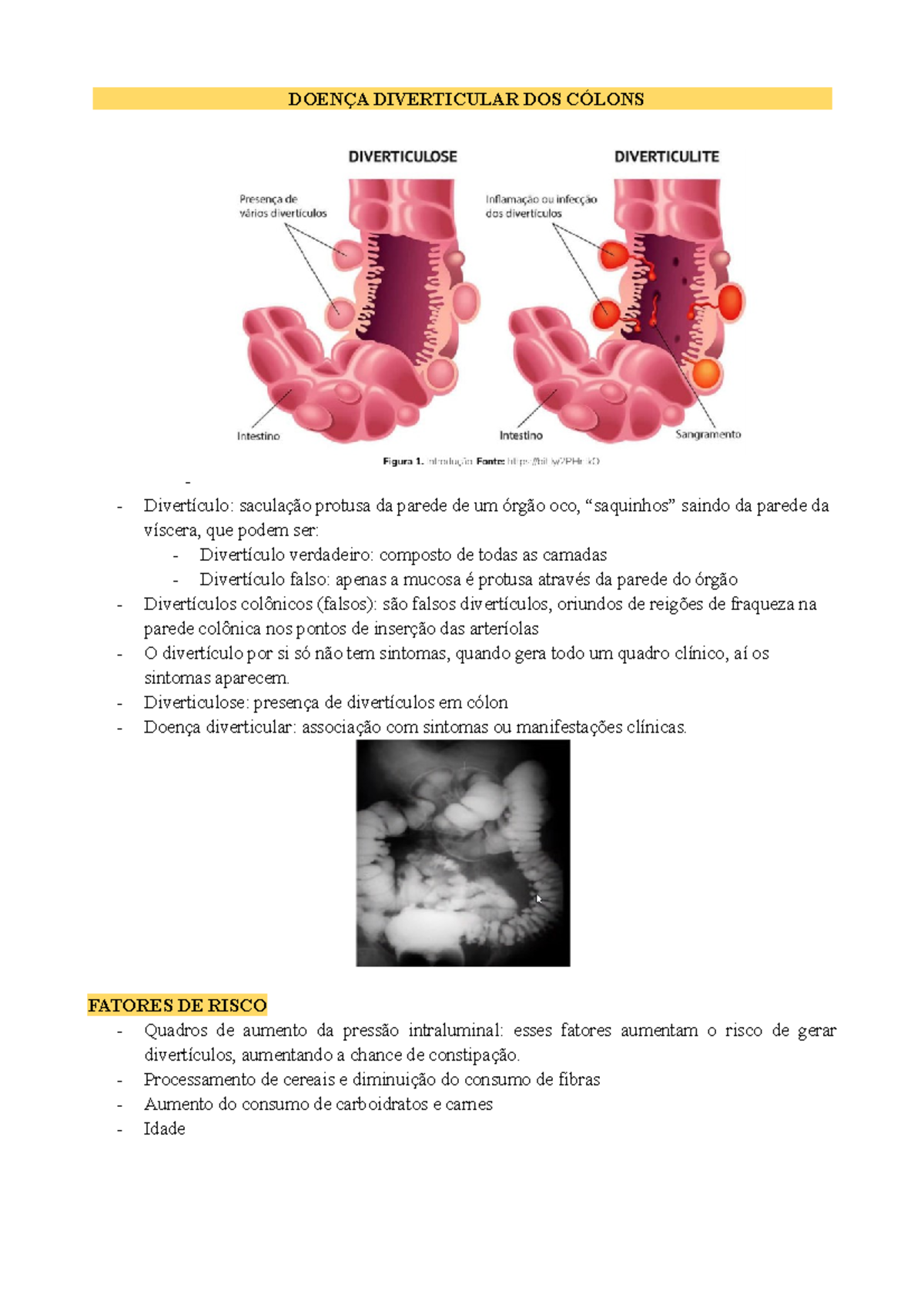 Como Tratar Doença Diverticular Do Cólon - NAZAEDU