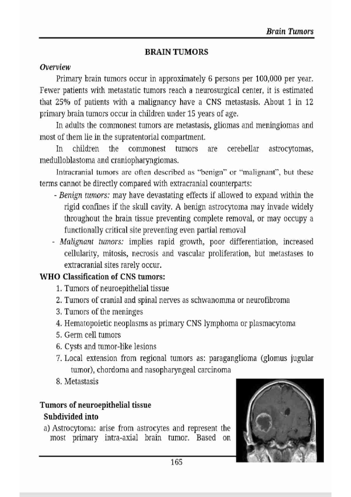 Brain tumor - centarl nervous system - Studocu
