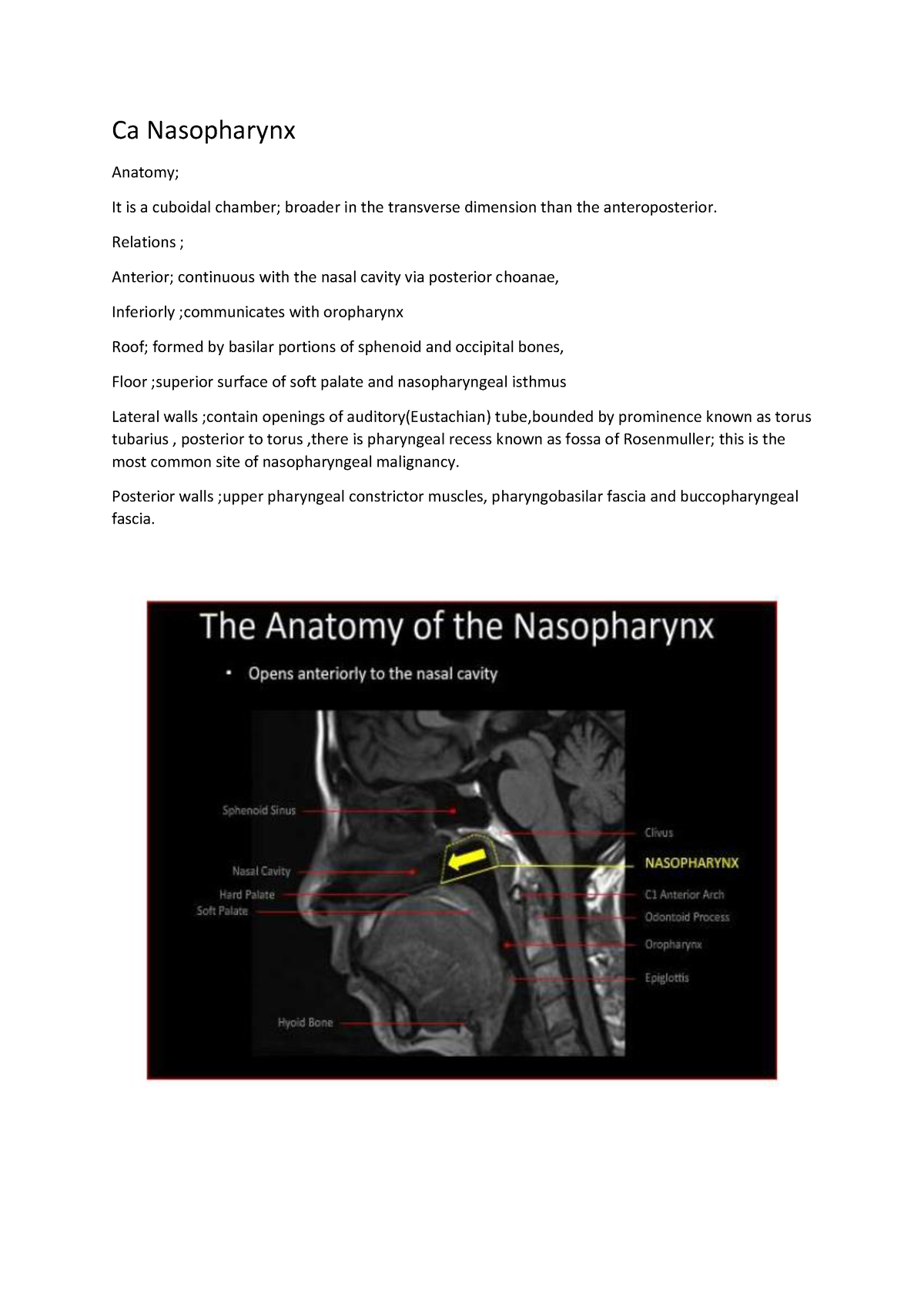 Ca Nasopharynx Drrt Notes - Ca Nasopharynx Anatomy; It Is A Cuboidal ...