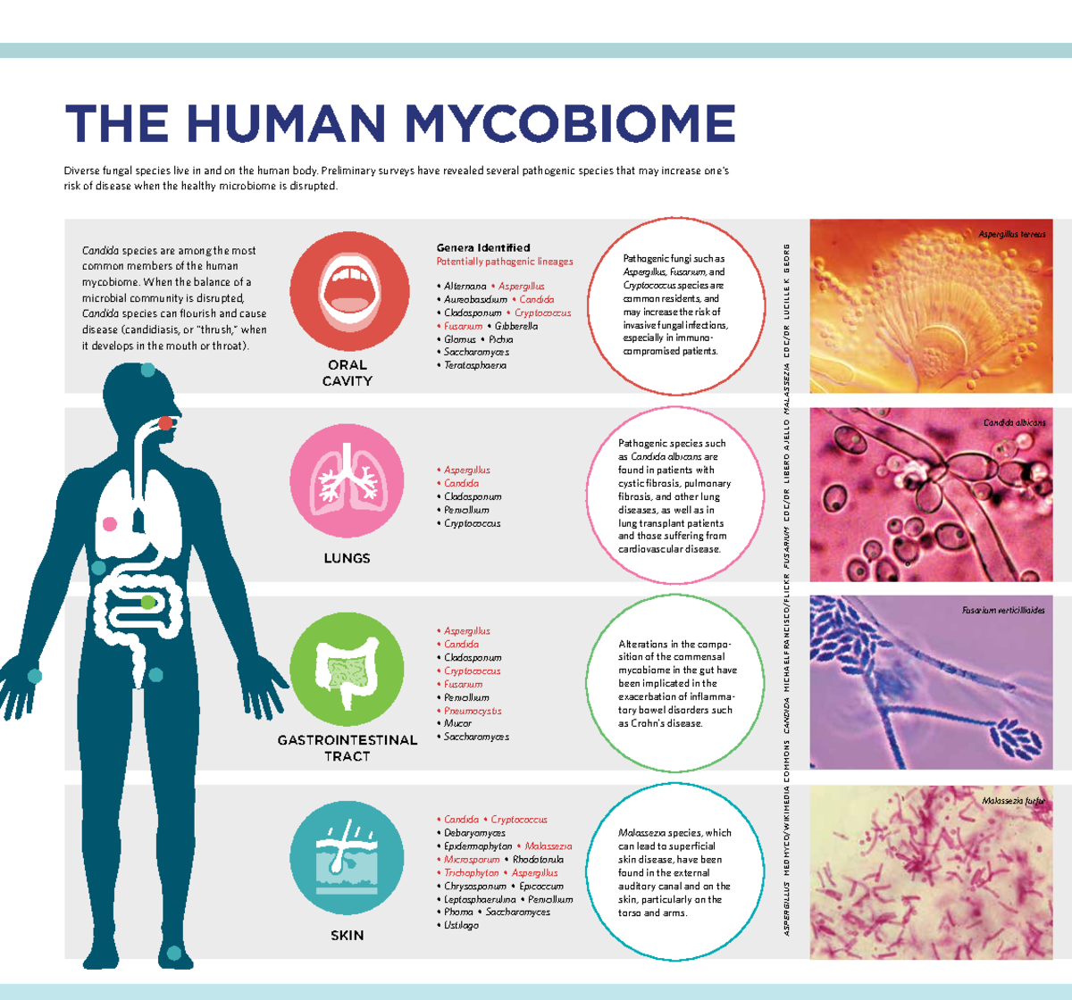 The Human Mycobiome low - THE HUMAN MYCOBIOME Diverse fungal species ...