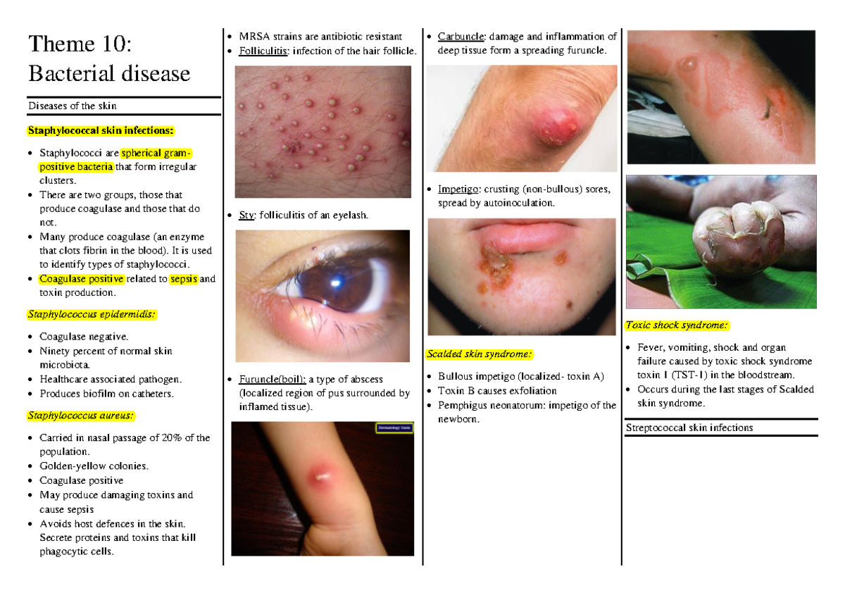 Theme 10 - BOT161 - Theme 10: Bacterial disease Diseases of the skin ...