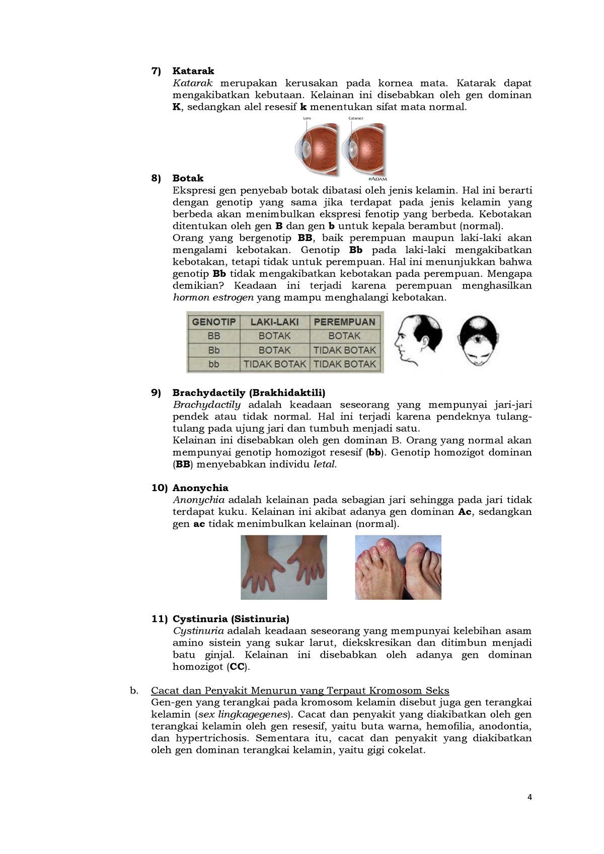 Materi Pembelajaran BAB Hereditas Manusi-4 - 4 Katarak Katarak ...