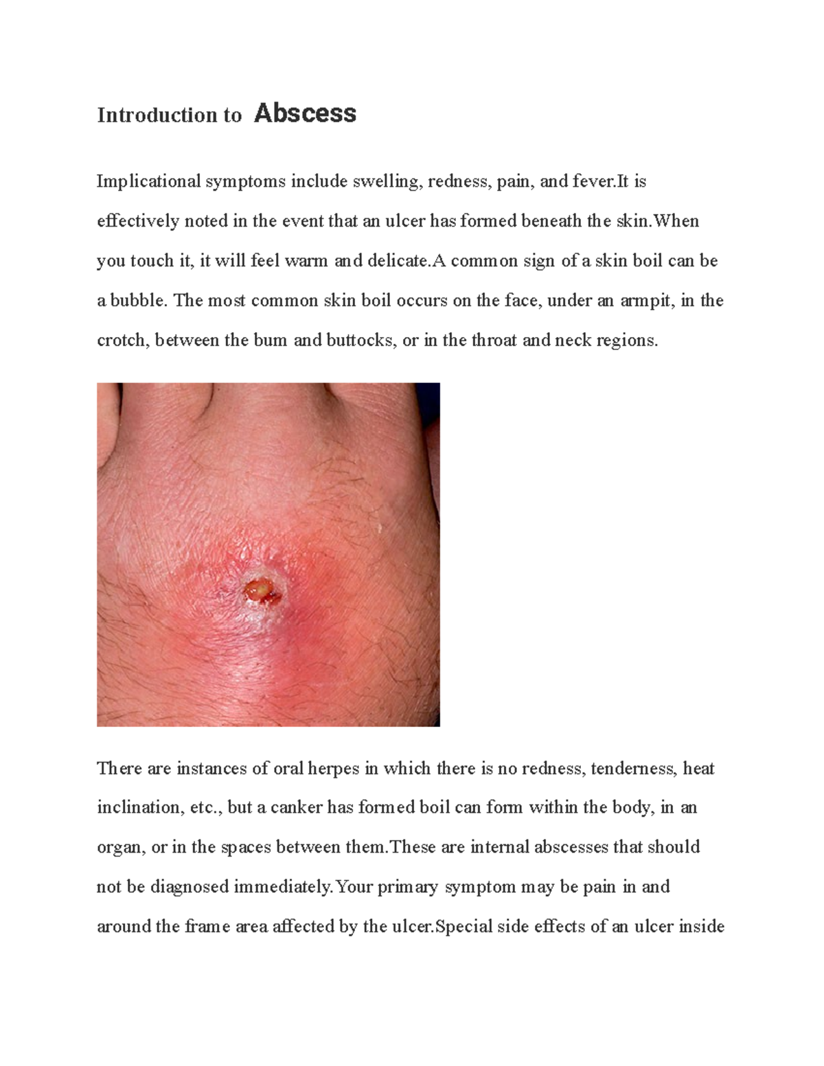 Abscess Introduction to Abscess Implicational symptoms include