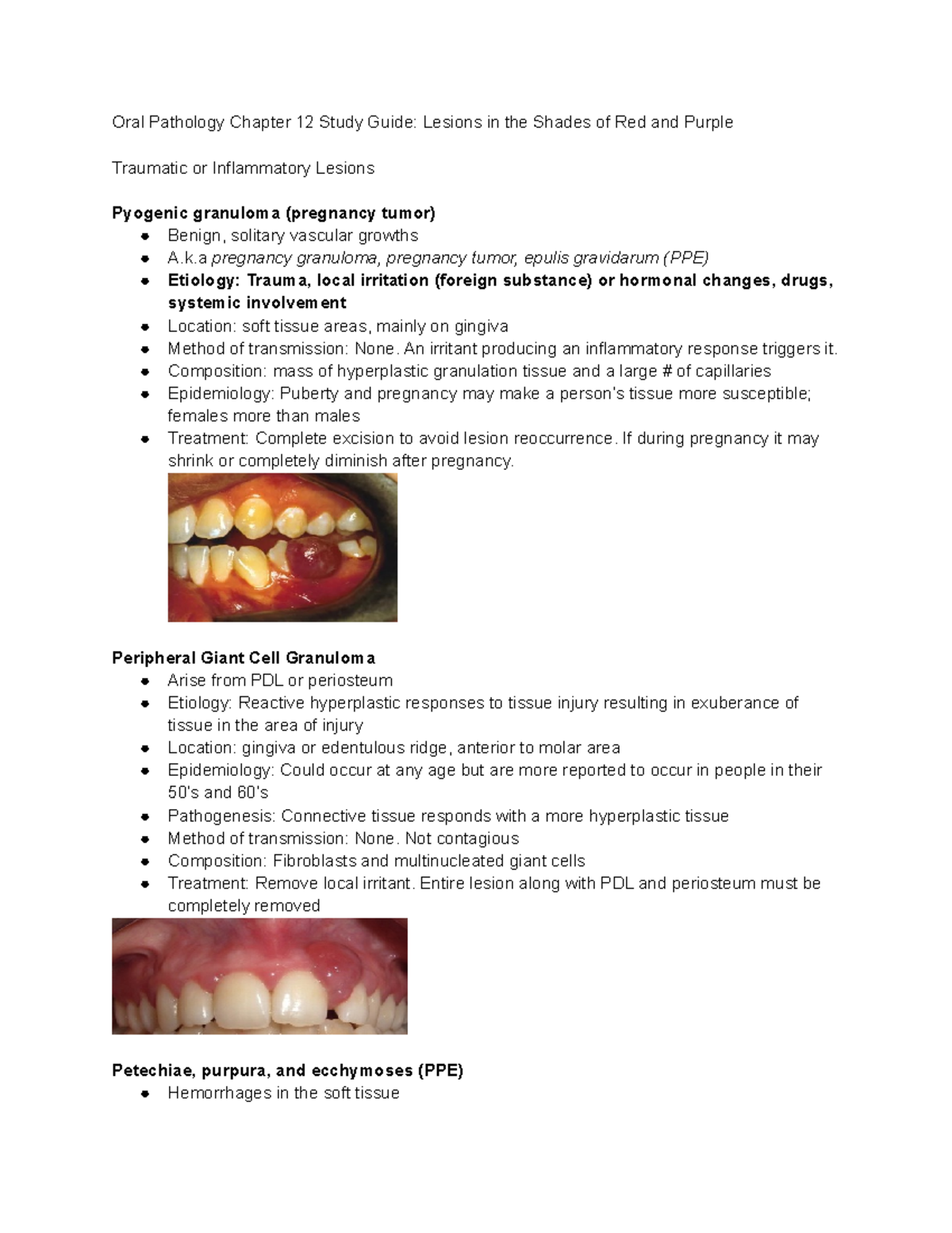 Oral Path Study Guide Ch 12 Oral Pathology Chapter 12 Study Guide