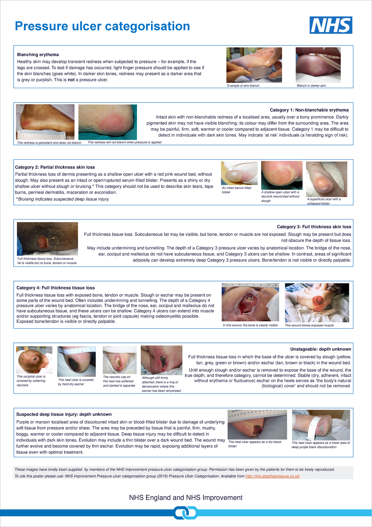 Pressure ulcer categorisation poster - Medicine and Surgery - OAU - Studocu