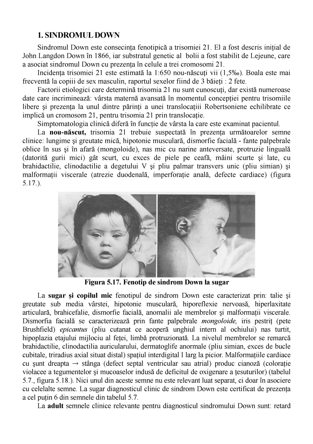 Lp6 Sindrom Down - Nimic - 1. SINDROMUL DOWN Sindromul Down Este ...