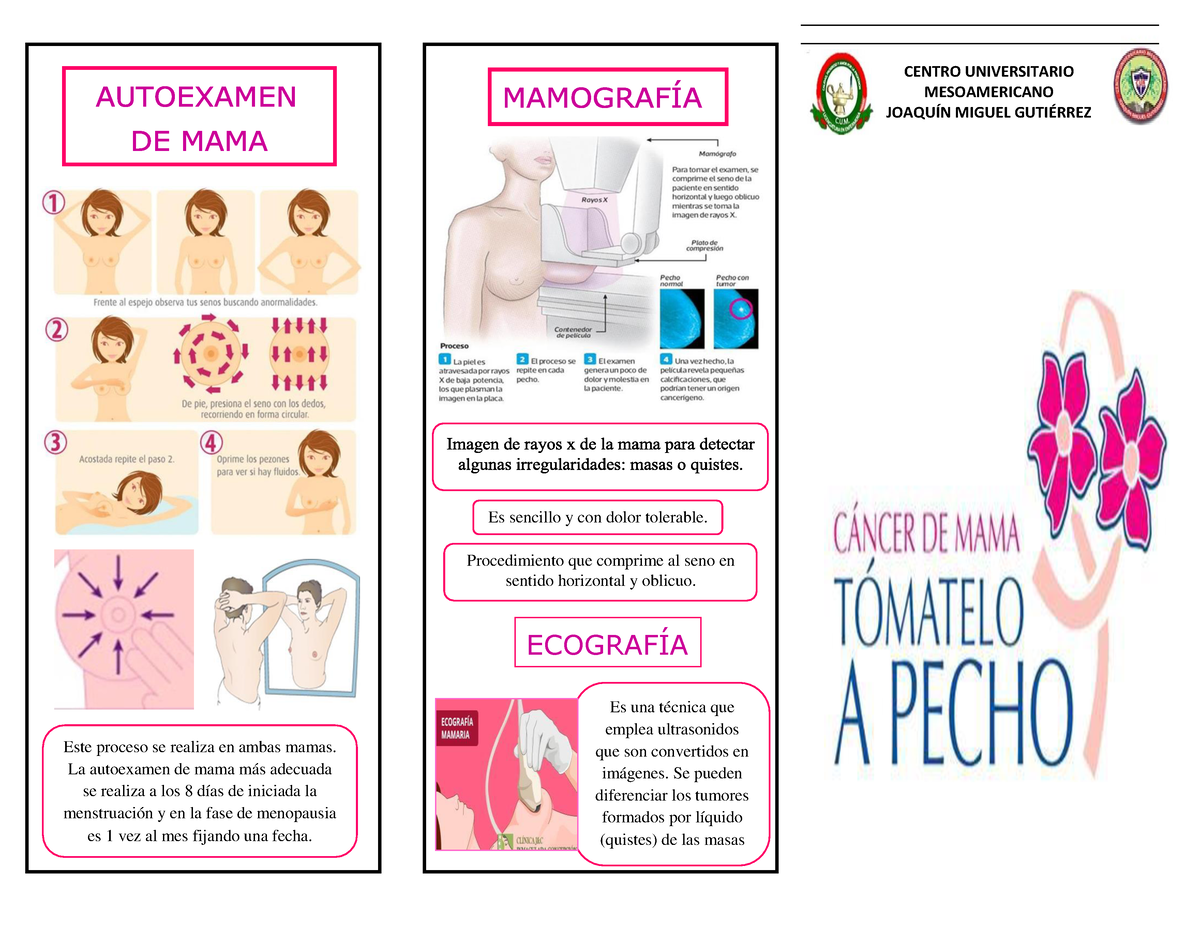 Cancer De Mama Triptico Pdf Este Proceso Se Realiza En Ambas Mamas La Autoexamen De Mama Más 5128