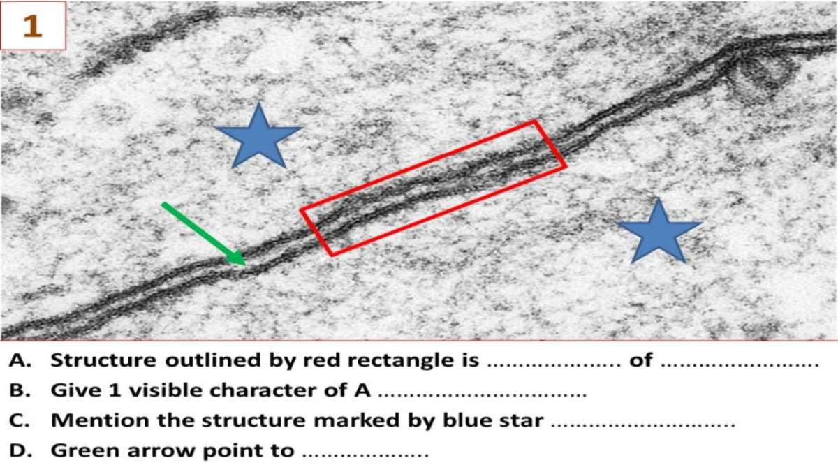 Practical Histology 101 - Answers Q 1 A. Structure outlined by red ...
