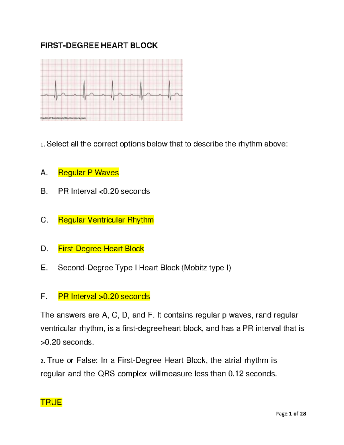 med-surg-practice-exam102-first-degree-heart-block-select-all-the