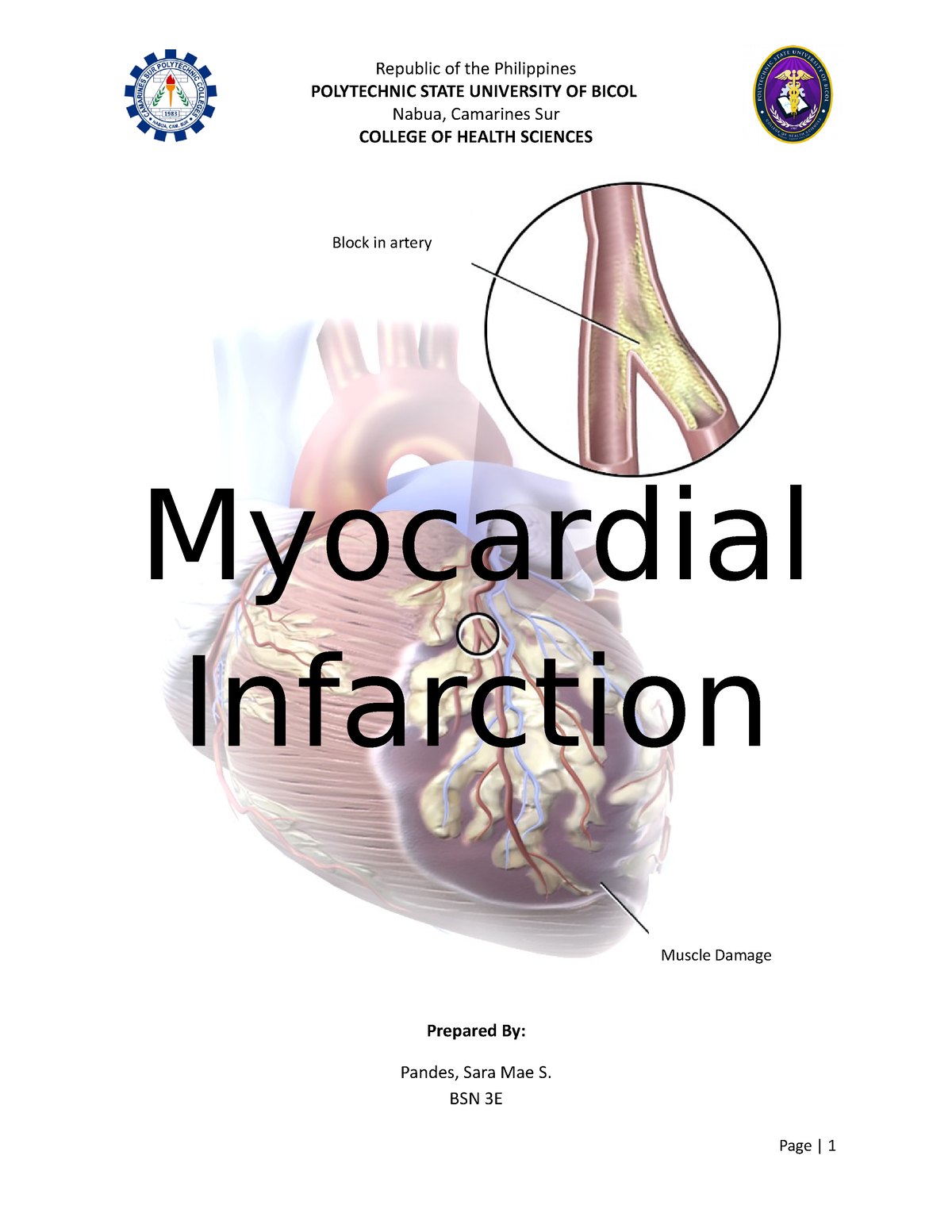 Myocardial Infarction - POLYTECHNIC STATE UNIVERSITY OF BICOL Nabua ...