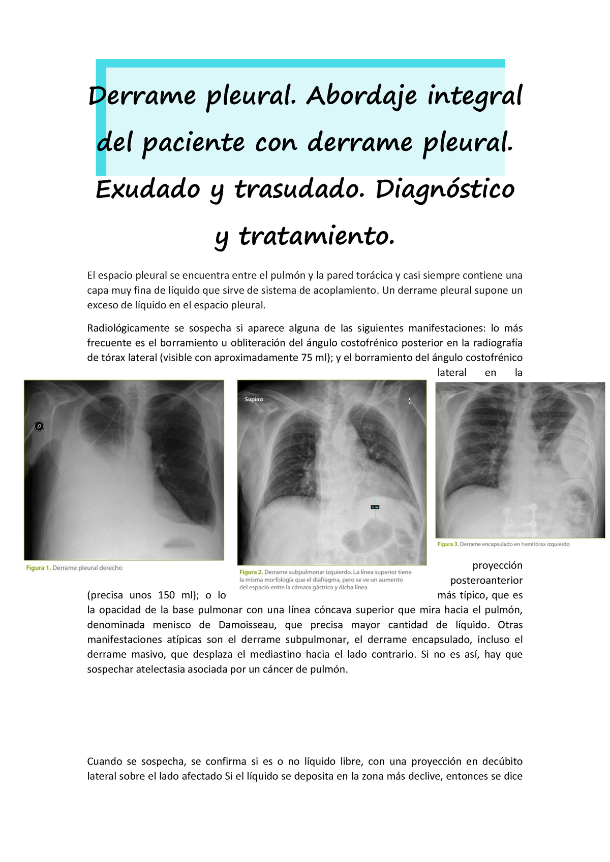 Derrame Pleural Abordaje Integral Del Paciente Con Derrame Pleural Exudado Y Trasudado Studocu