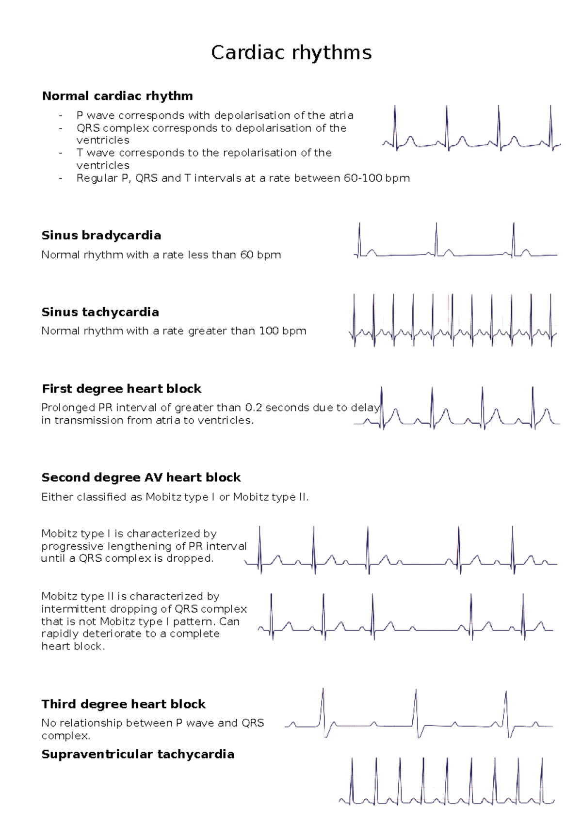 Cardiac rhythms for nursing - Health, Illness and Disability - AUT ...