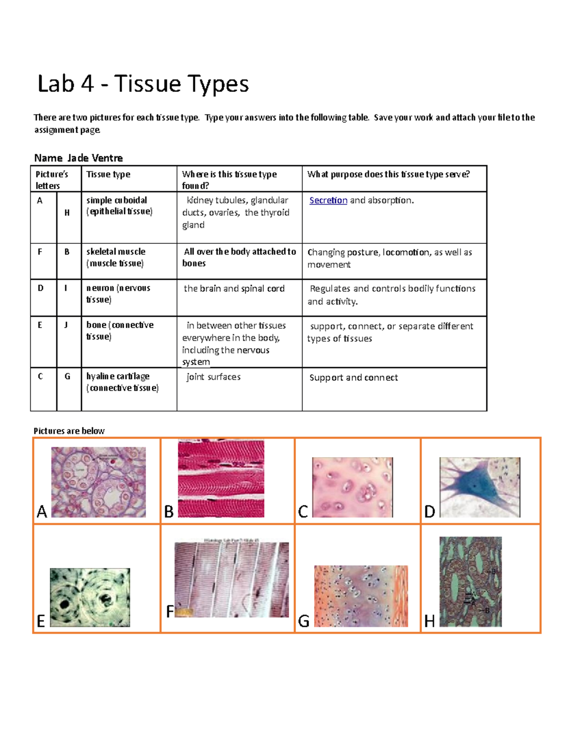 Drag Each Tissue Type To Its Correct Location - bv4qkmy