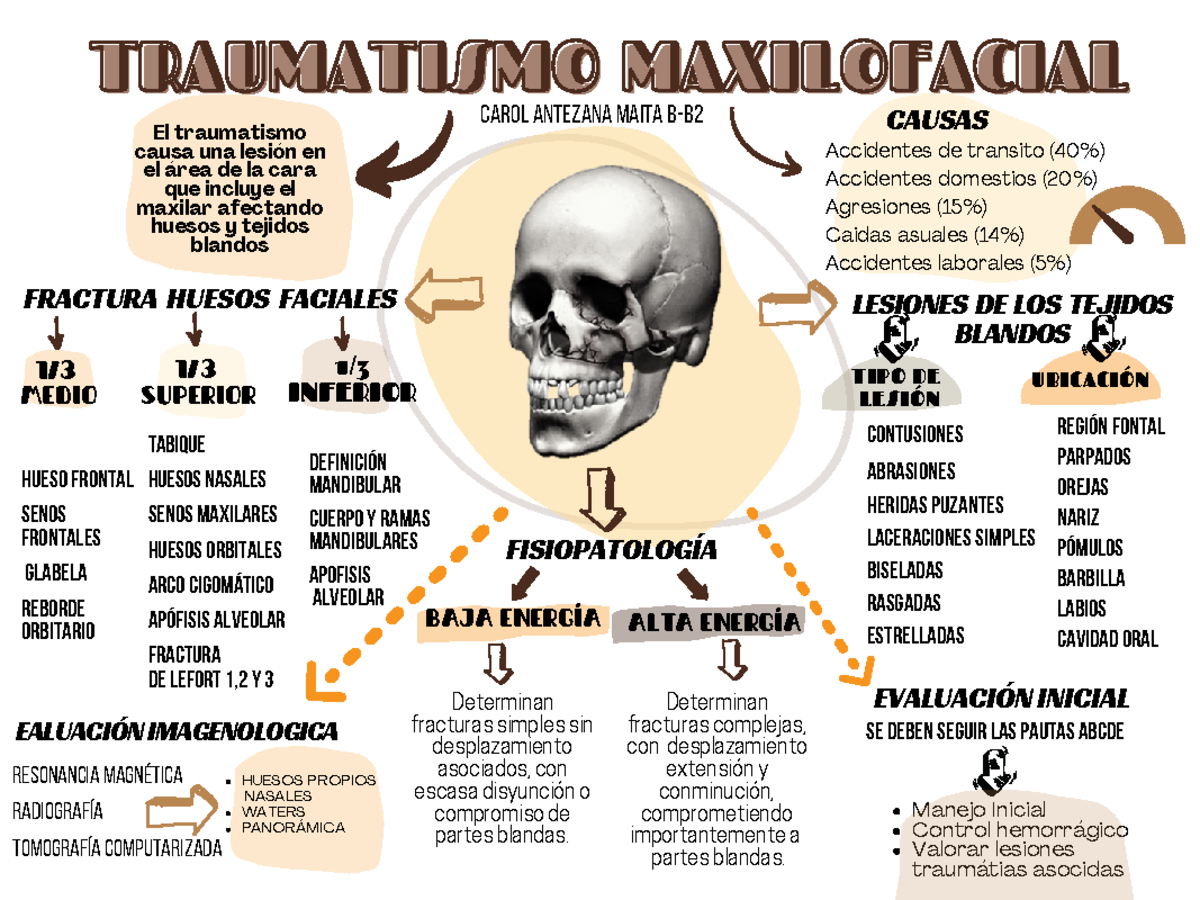 Mapa conceptual Traumatismo maxilofacial - Accidentes de transito (40%