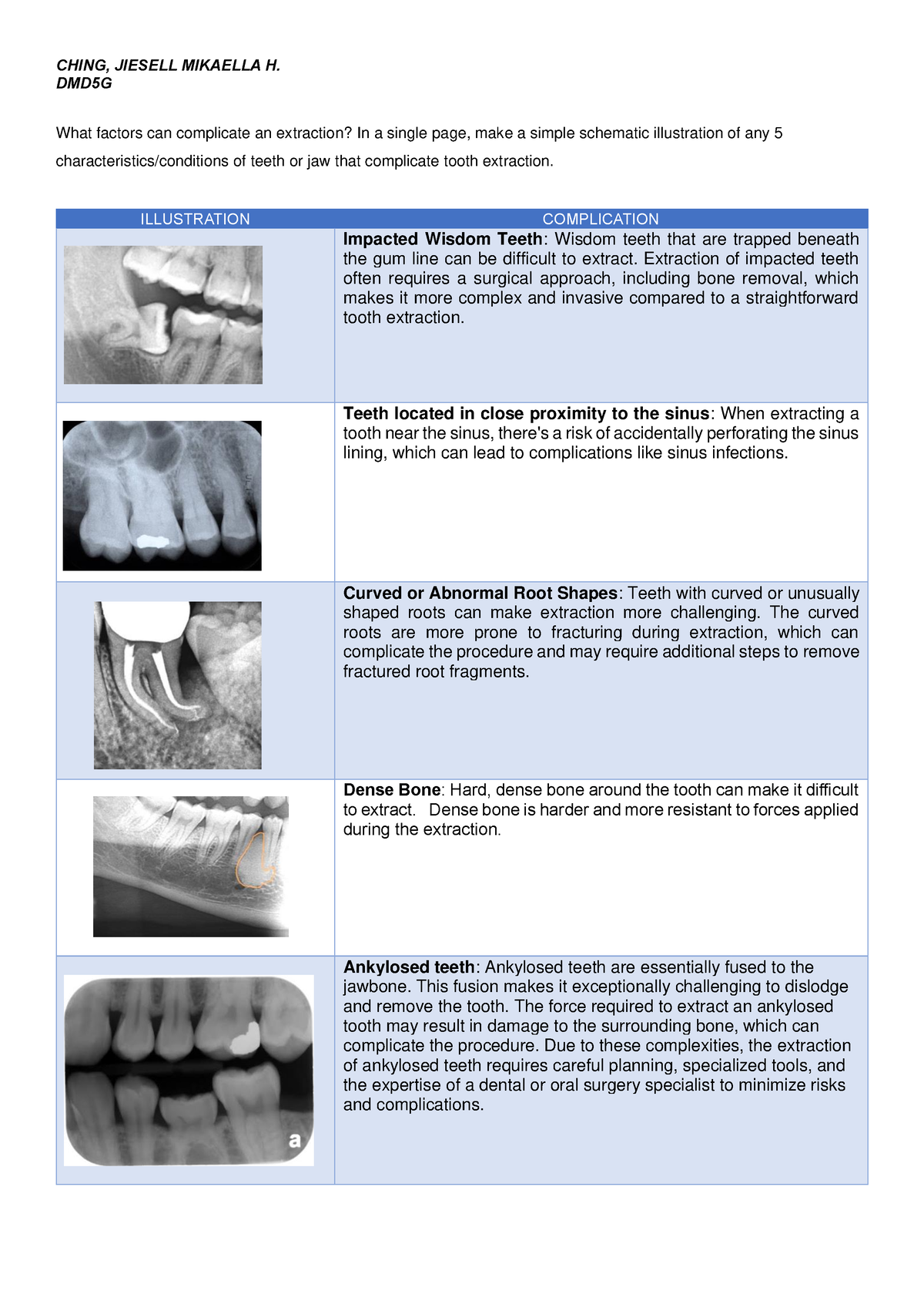 Dent: Oral surgery 1 - CHING, JIESELL MIKAELLA H. DMD5G What factors ...