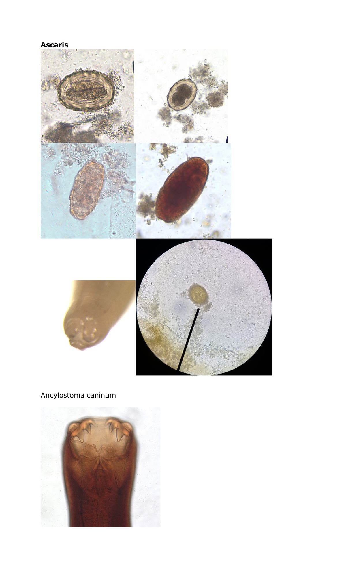 Parasites - Ascaris Ancylostoma caninum A Brugia malayi C. belli C