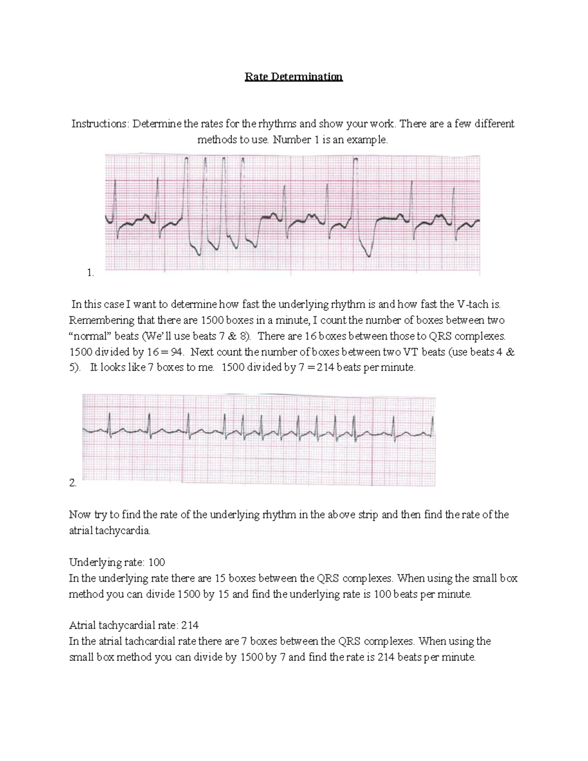 Rate Determination - Assessing ekg rhythm - Rate Determination ...