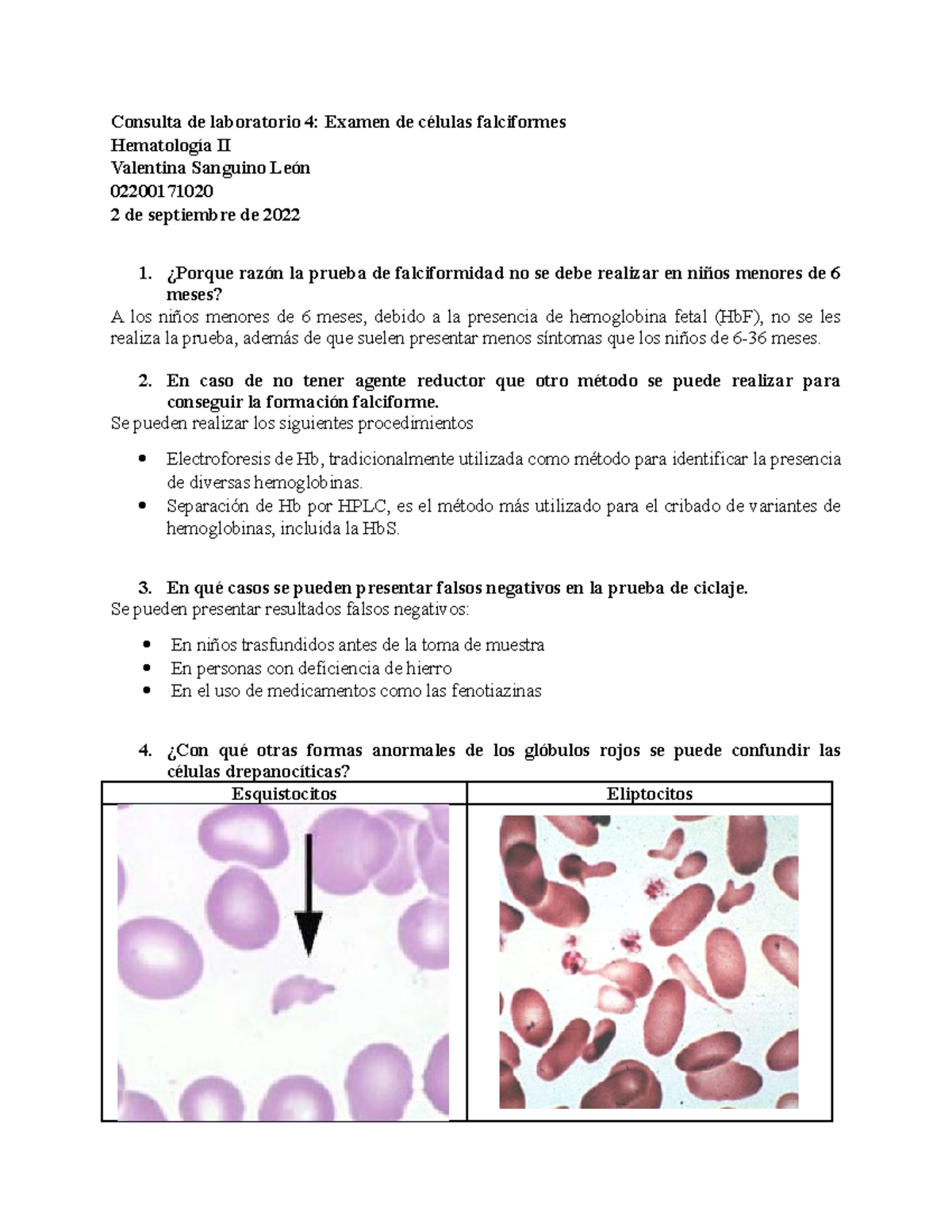 Consulta DE LAB 4 - Examen De Células Falciformes - Consulta De ...