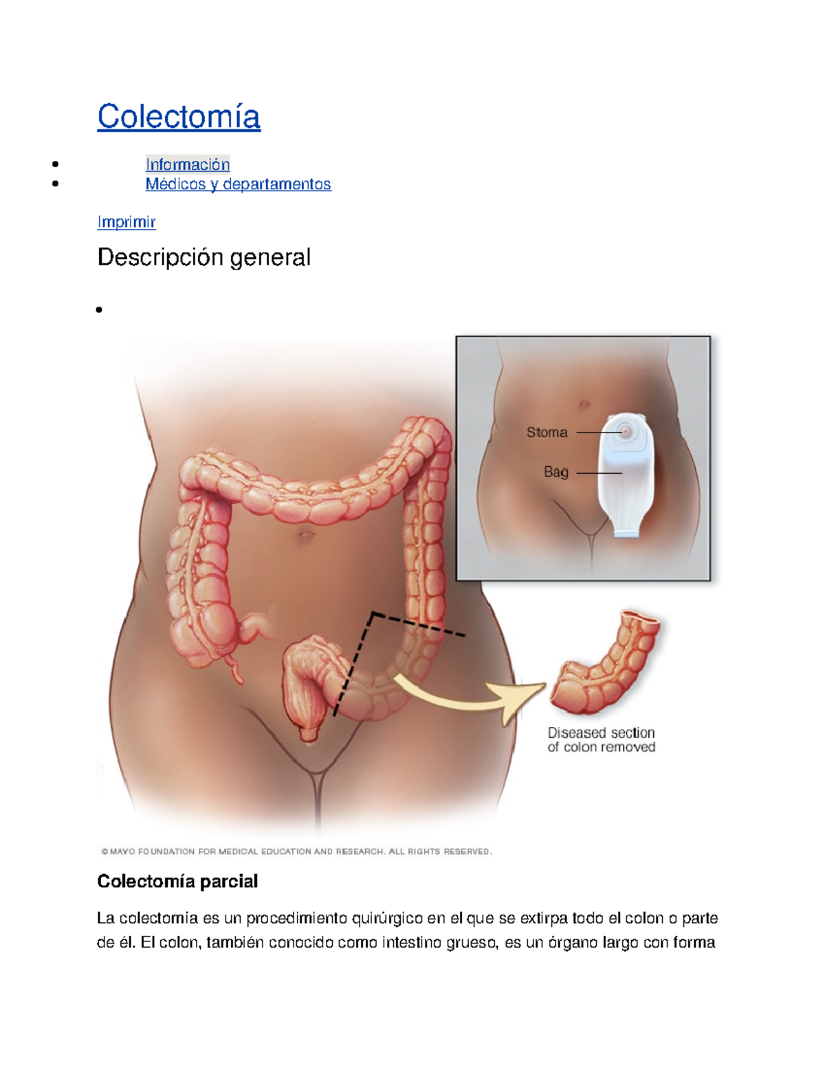 Colectomia Colectomia Studocu