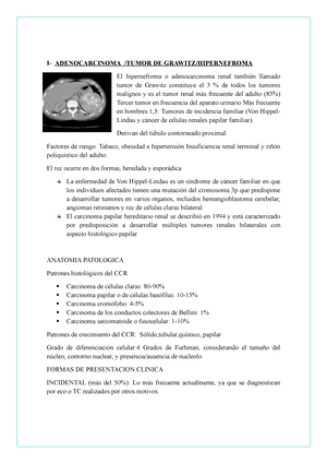 Adenocarcinoma -  - Smith y Tanagho: urologa general (18a. ed.) - I-  ADENOCARCINOMA /TUMOR DE - Studocu