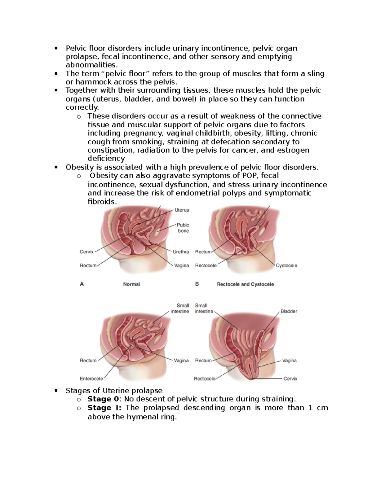 Chapter 7 Mat - Maternity - Pelvic floor disorders include urinary ...