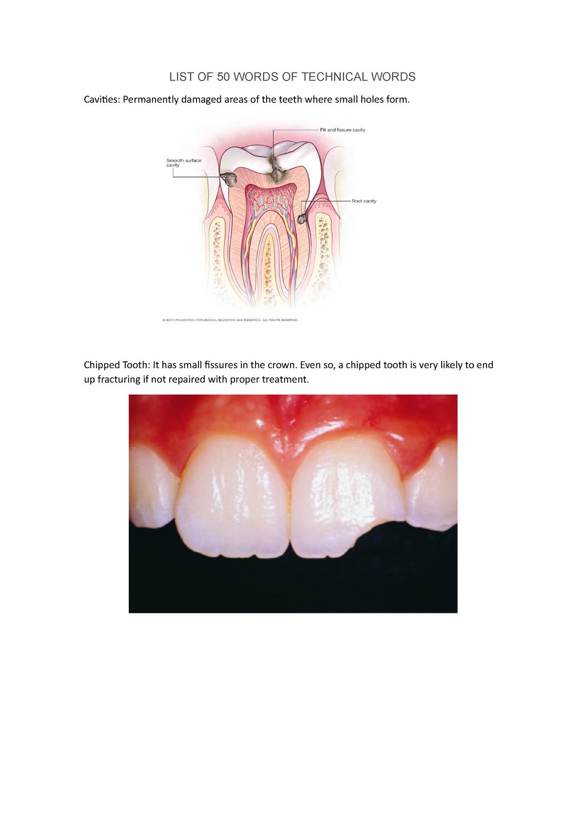 list-of-50-words-of-technical-words-list-of-50-words-of-technical-words-cavities-permanently