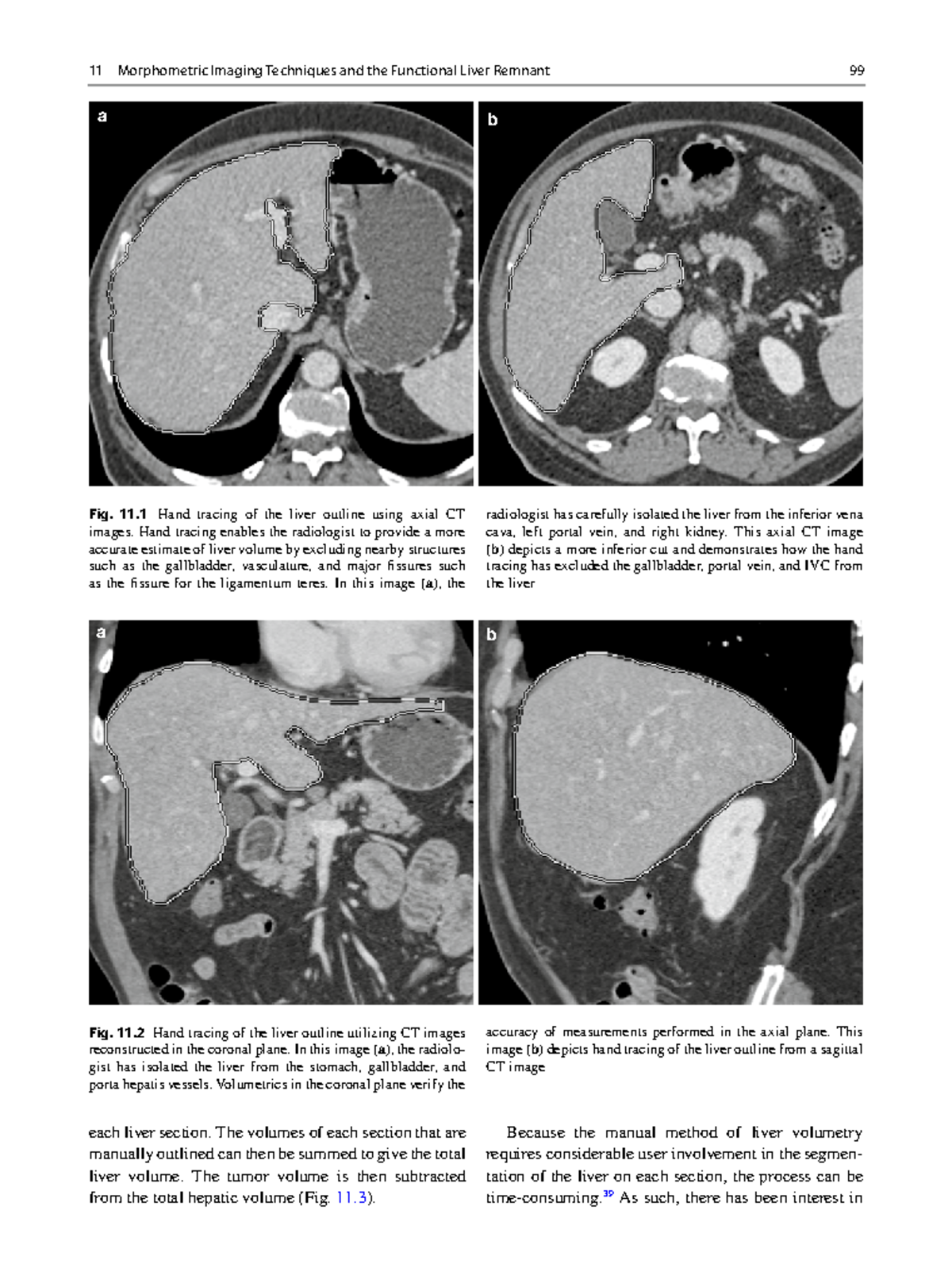 Radiologic and Surgical Practice (2)-31 - 11 Morphometric Imaging ...