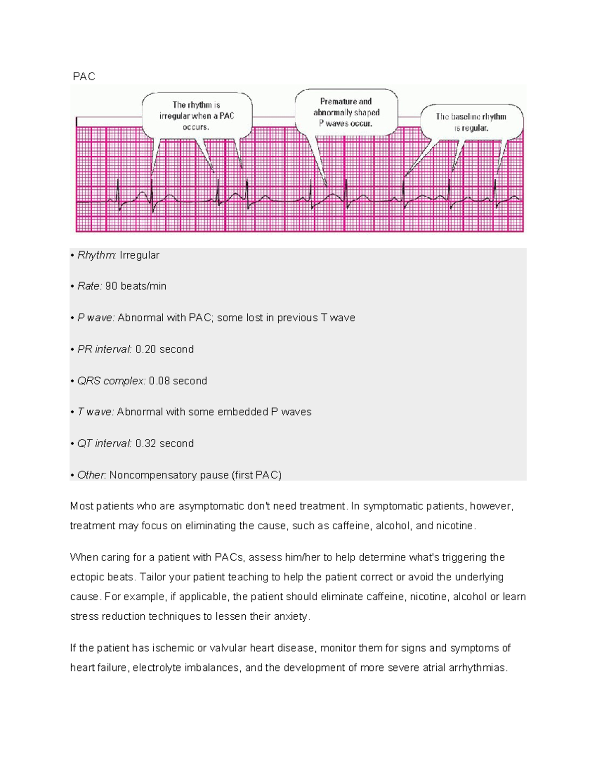 ECG heart block strips - PAC Rhythm: Irregular Rate: 90 beats/min P ...