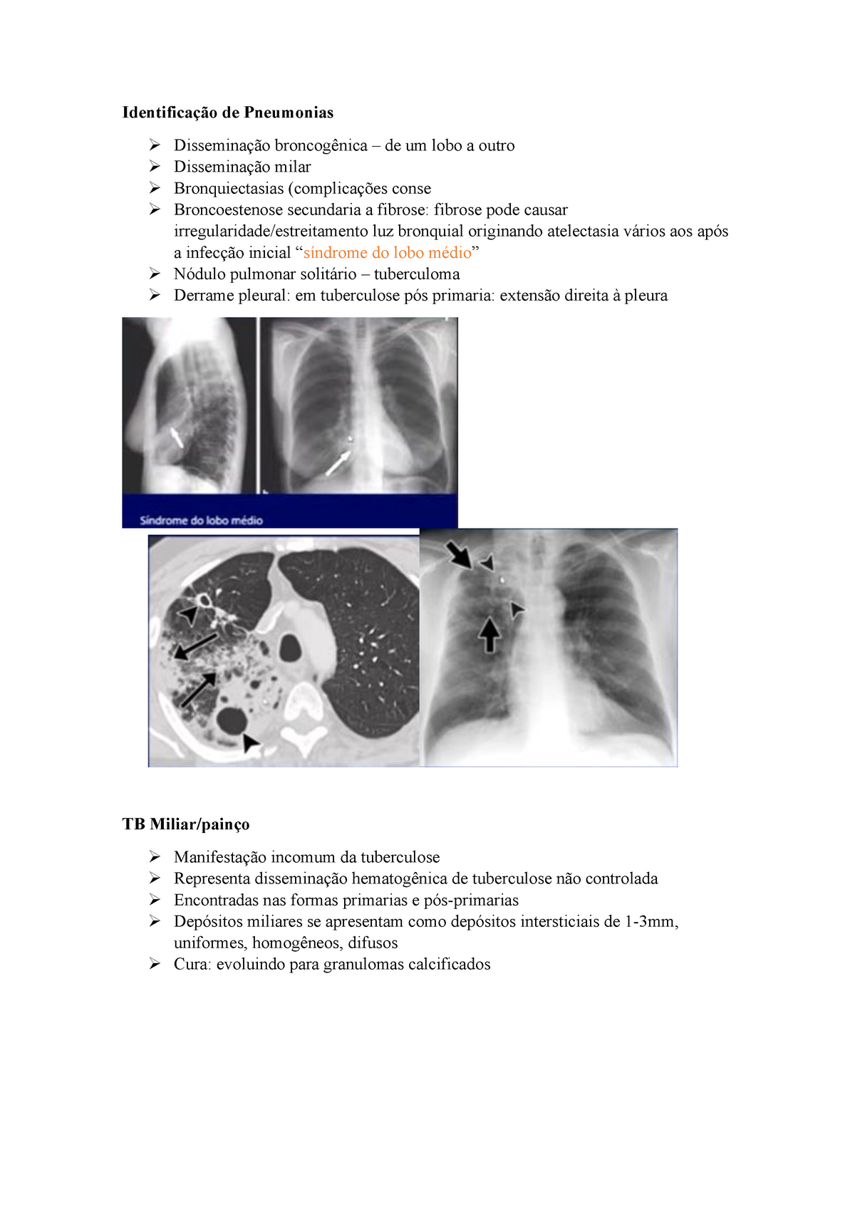 Imaginologia - Pneumonias Lobares + Intersticiais - Identificação De ...