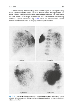 Fundamentals of Nuclear Pharmacy V-36 - 341 negative scan is based on ...
