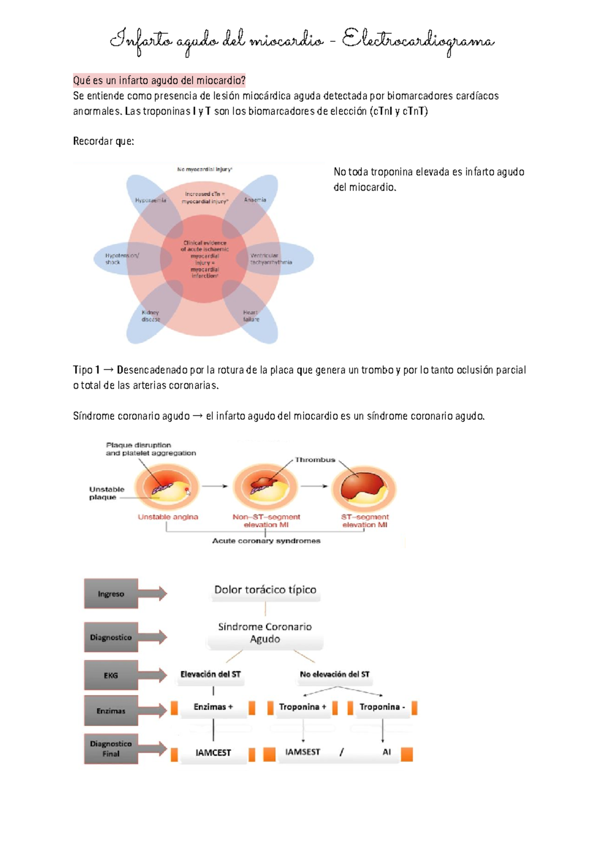 2 Infarto agudo del miocardio - Electrocardiograma - Las troponinas I y ...