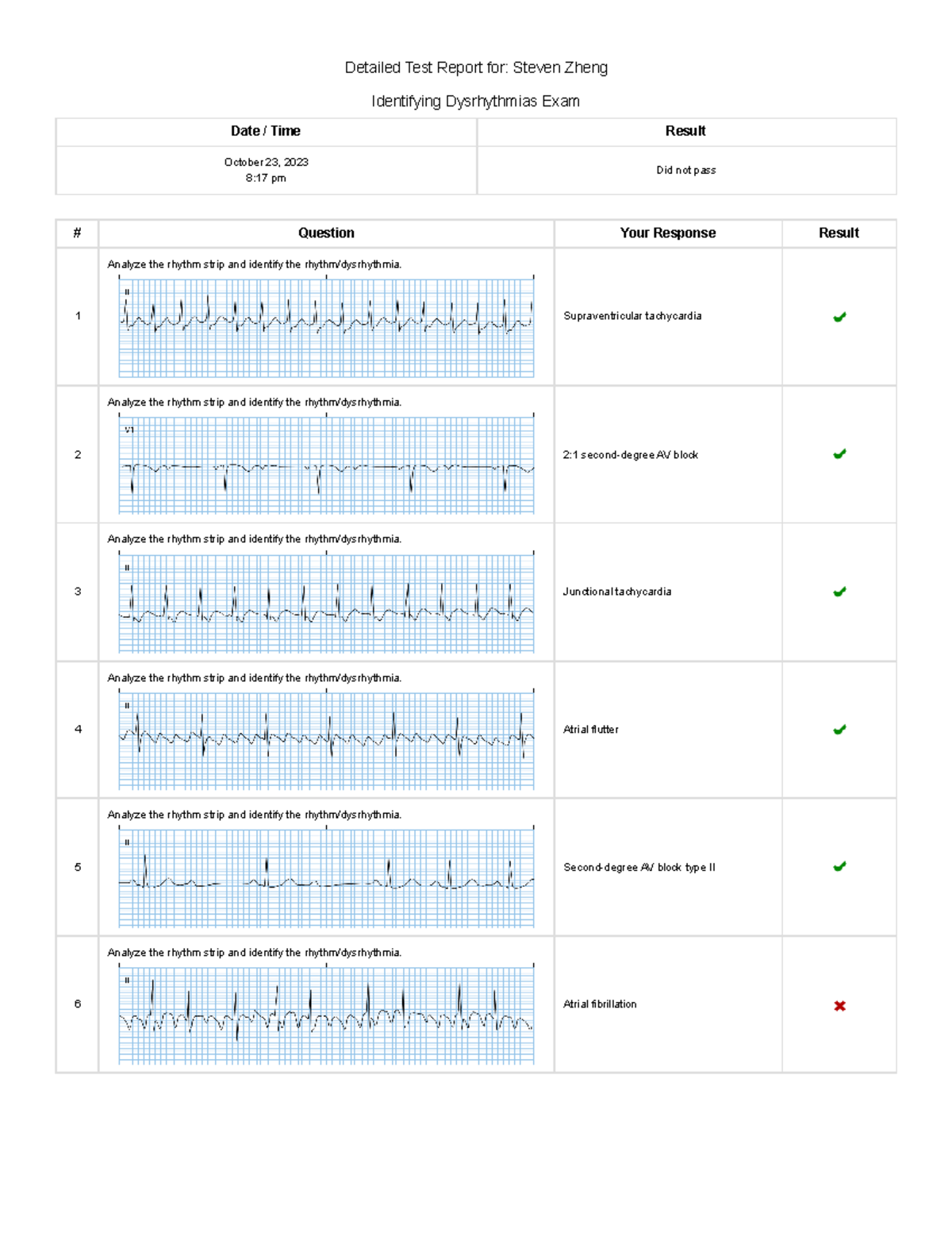 ECG2 - Detailed Test Report for: Steven Zheng Identifying Dysrhythmias ...