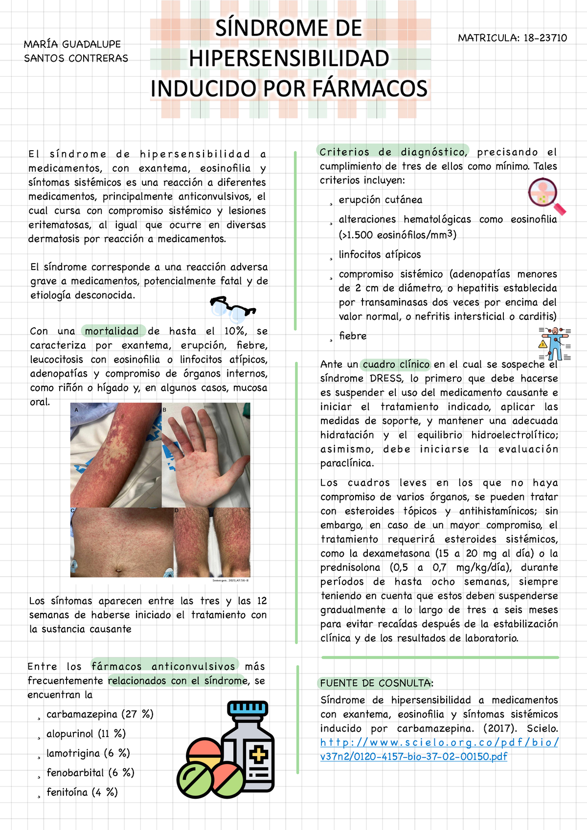 SciELO - Brasil - Síndrome DRESS e lúpus eritematoso sistêmico